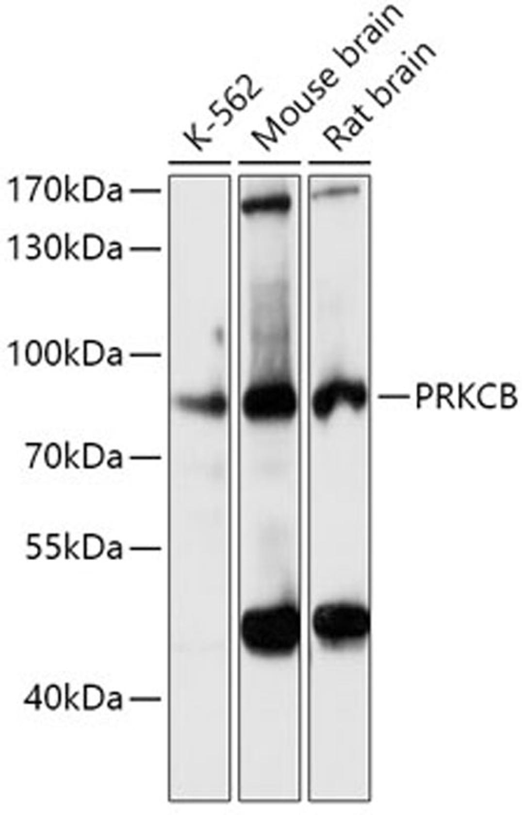 Western blot - PRKCB antibody (A5845)