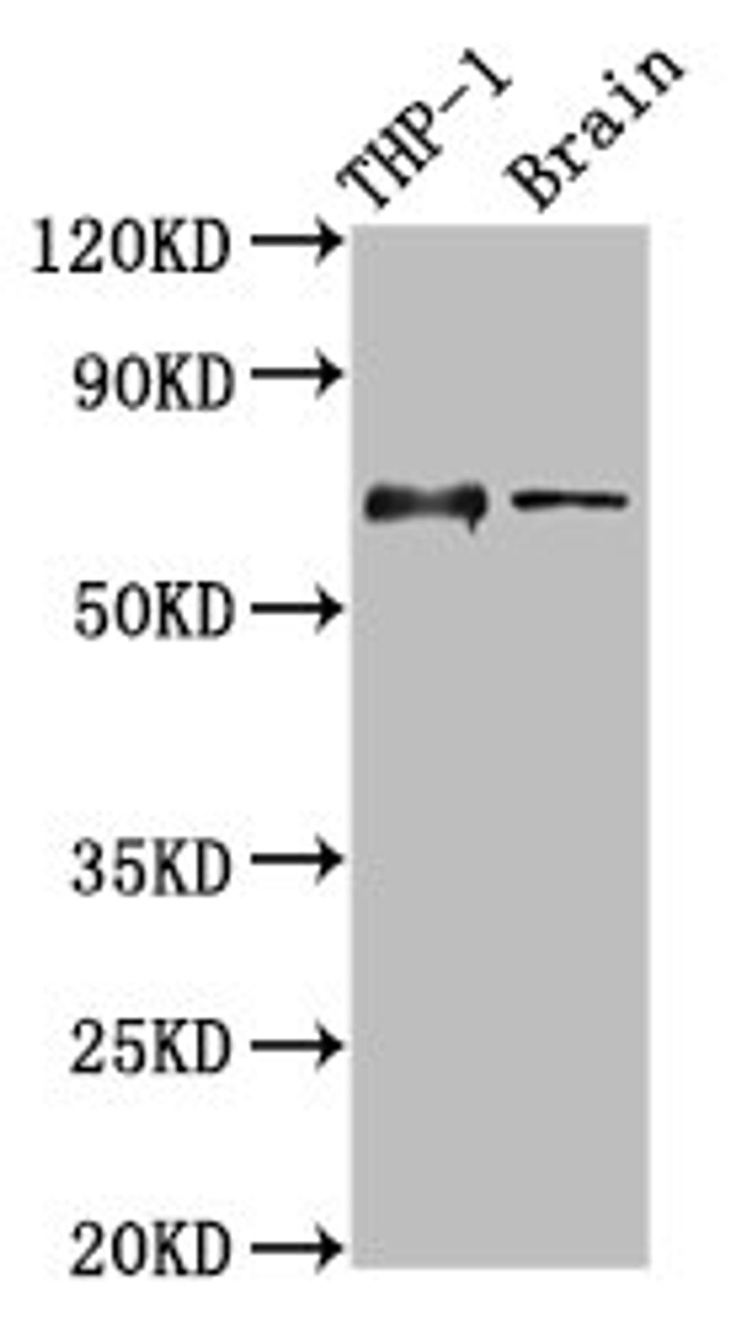 Western Blot. Positive WB detected in: THP-1 whole cell lysate, Rat brain tissue. All lanes: LILRB1 antibody at 3.5µg/ml. Secondary. Goat polyclonal to rabbit IgG at 1/50000 dilution. Predicted band size: 71, 72, 50 kDa. Observed band size: 71 kDa