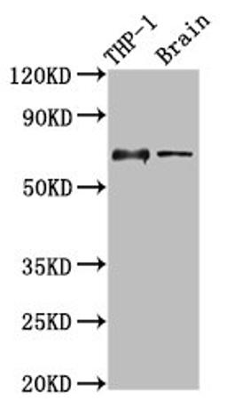 Western Blot. Positive WB detected in: THP-1 whole cell lysate, Rat brain tissue. All lanes: LILRB1 antibody at 3.5µg/ml. Secondary. Goat polyclonal to rabbit IgG at 1/50000 dilution. Predicted band size: 71, 72, 50 kDa. Observed band size: 71 kDa