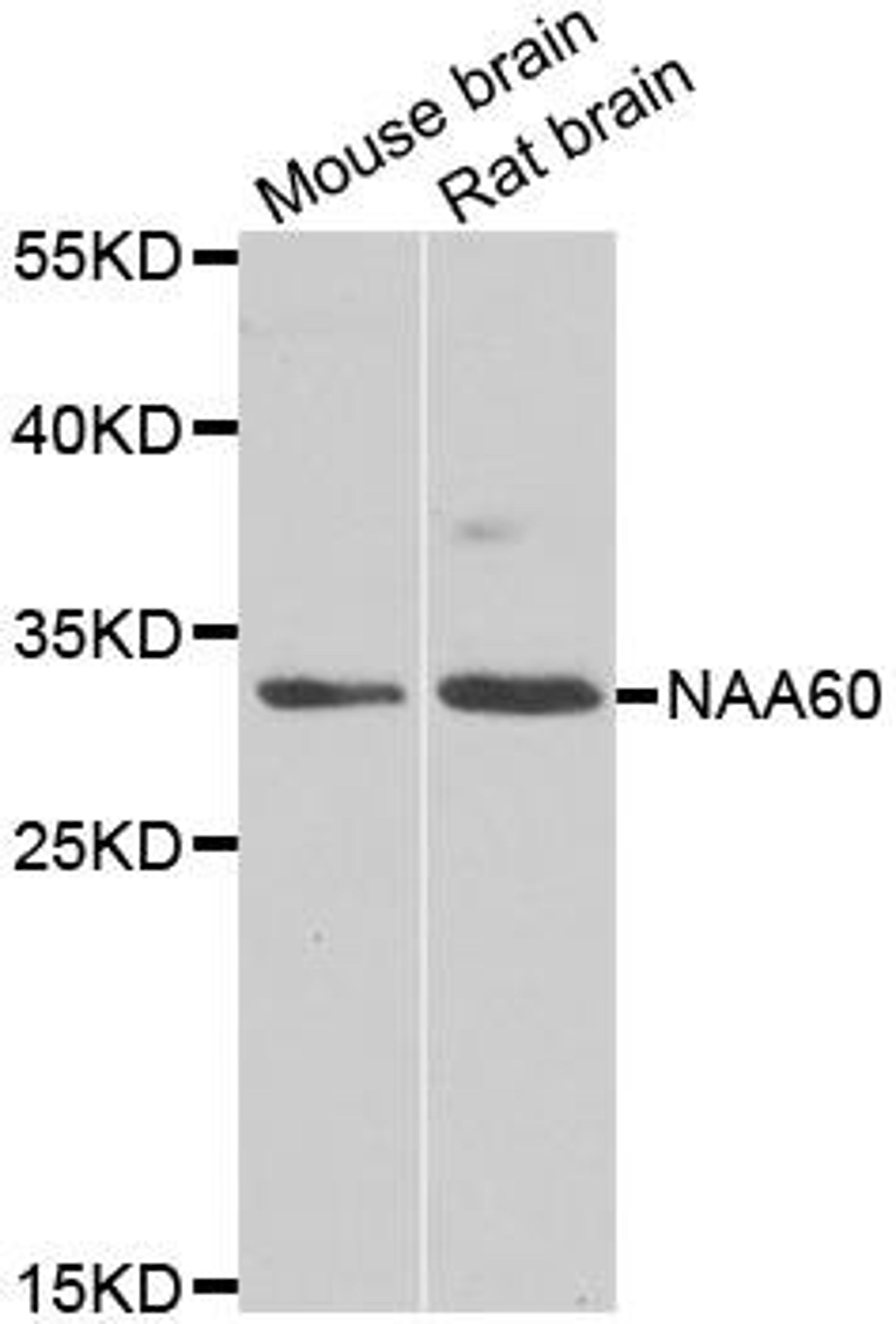 Western blot analysis of extracts of various cell lines using NAA60 antibody