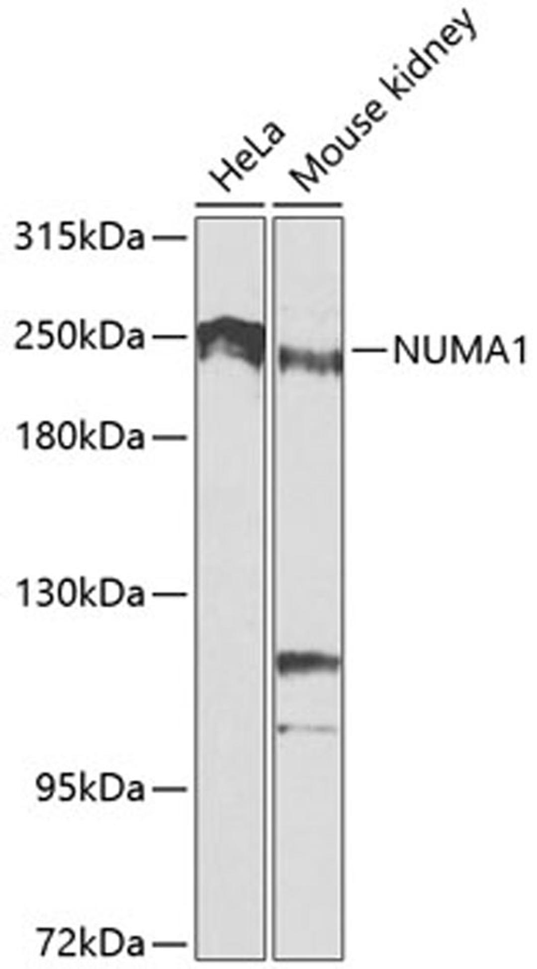 Western blot - NUMA1 antibody (A0527)