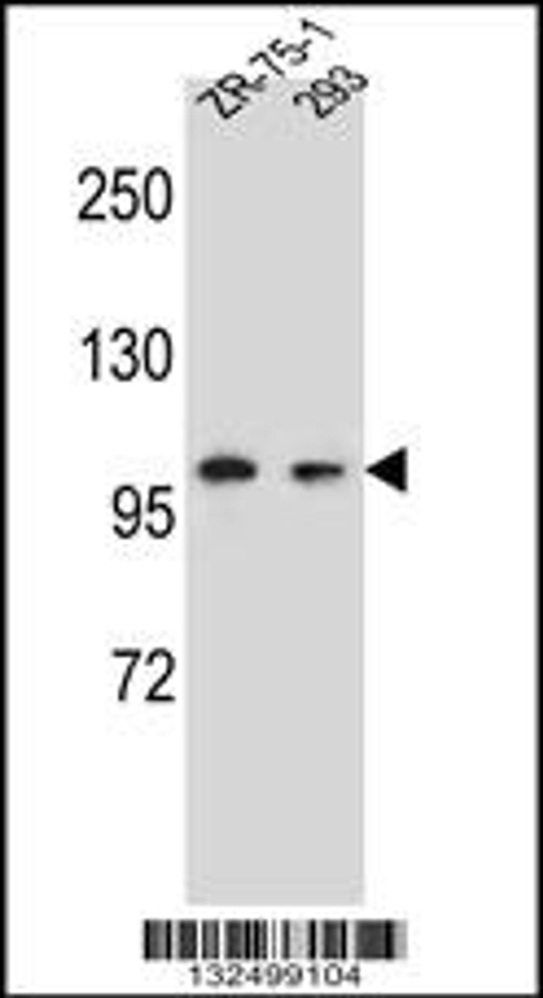 Western blot analysis in ZR-75-1,293 cell line lysates (35ug/lane).