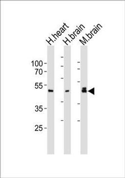 Western blot analysis of human heart, human brain, mouse brain tissue lysate (from left to right) using NDEL1 antibody (primary antibody dilution at: 1:1000)