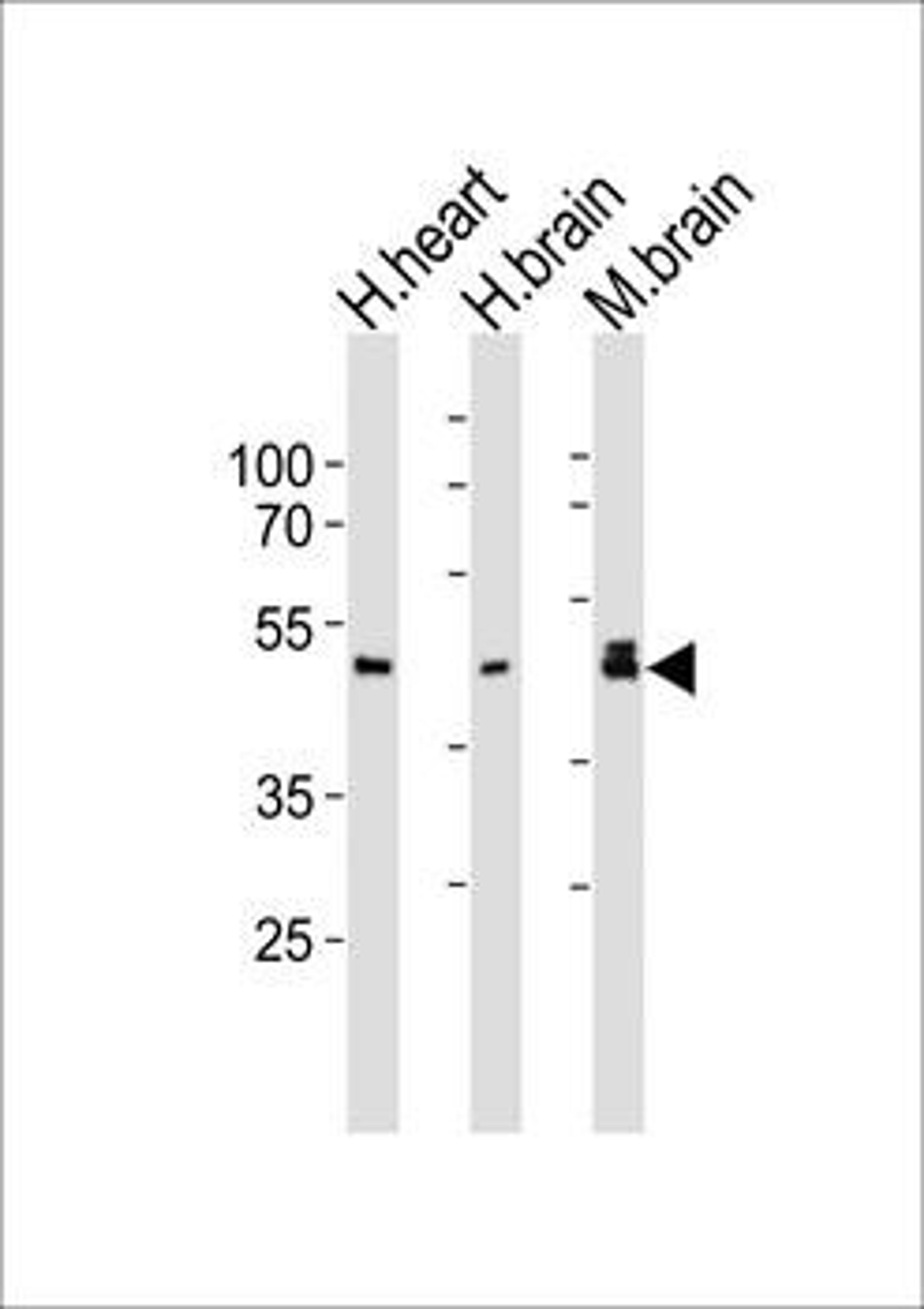 Western blot analysis of human heart, human brain, mouse brain tissue lysate (from left to right) using NDEL1 antibody (primary antibody dilution at: 1:1000)