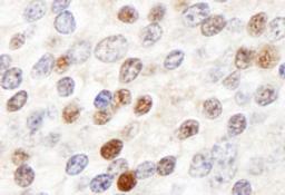 Detection of human ZHX3 by immunohistochemistry.