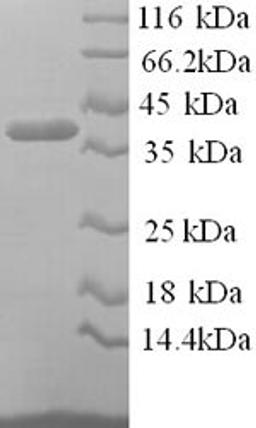 (Tris-Glycine gel) Discontinuous SDS-PAGE (reduced) with 5% enrichment gel and 15% separation gel.