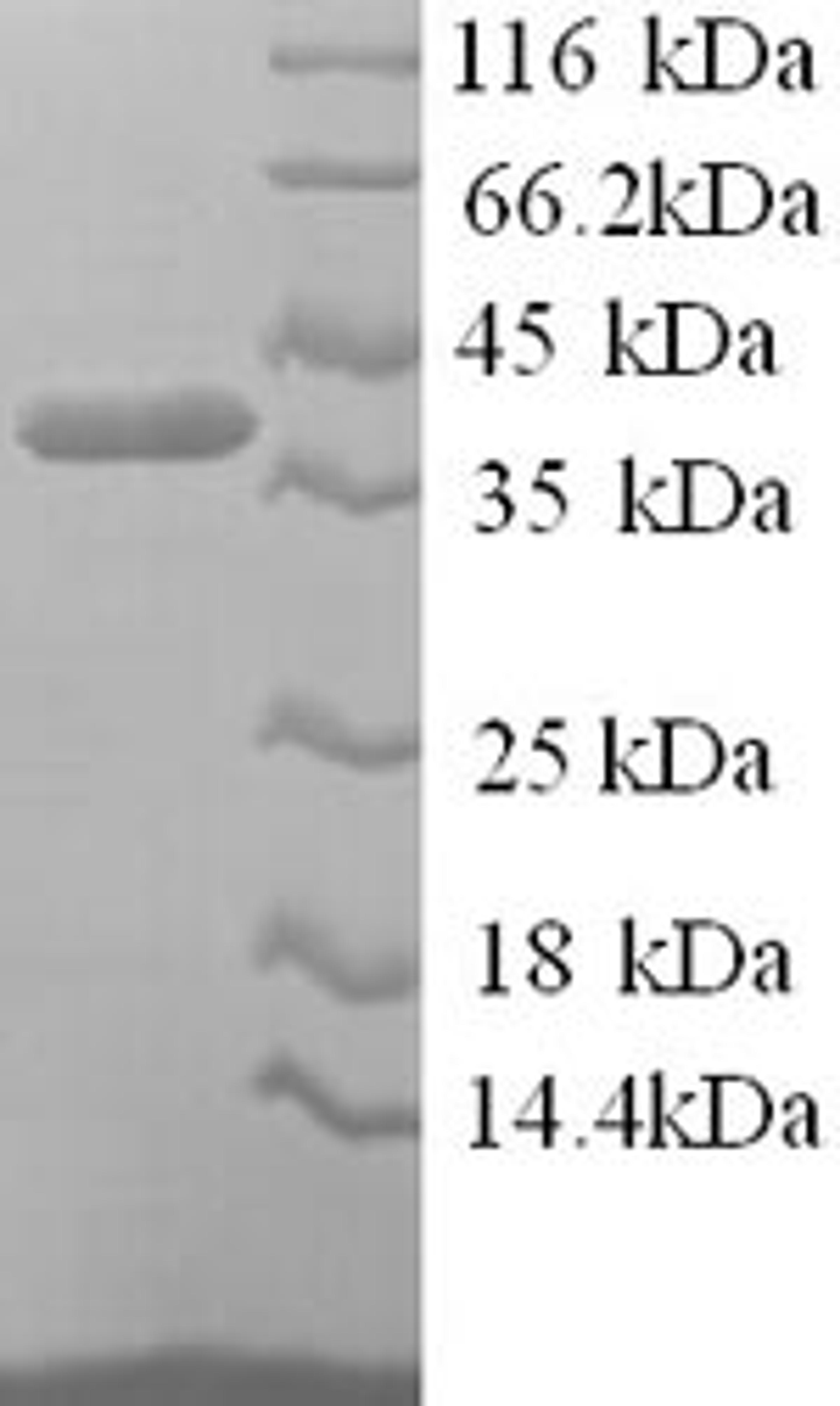 (Tris-Glycine gel) Discontinuous SDS-PAGE (reduced) with 5% enrichment gel and 15% separation gel.