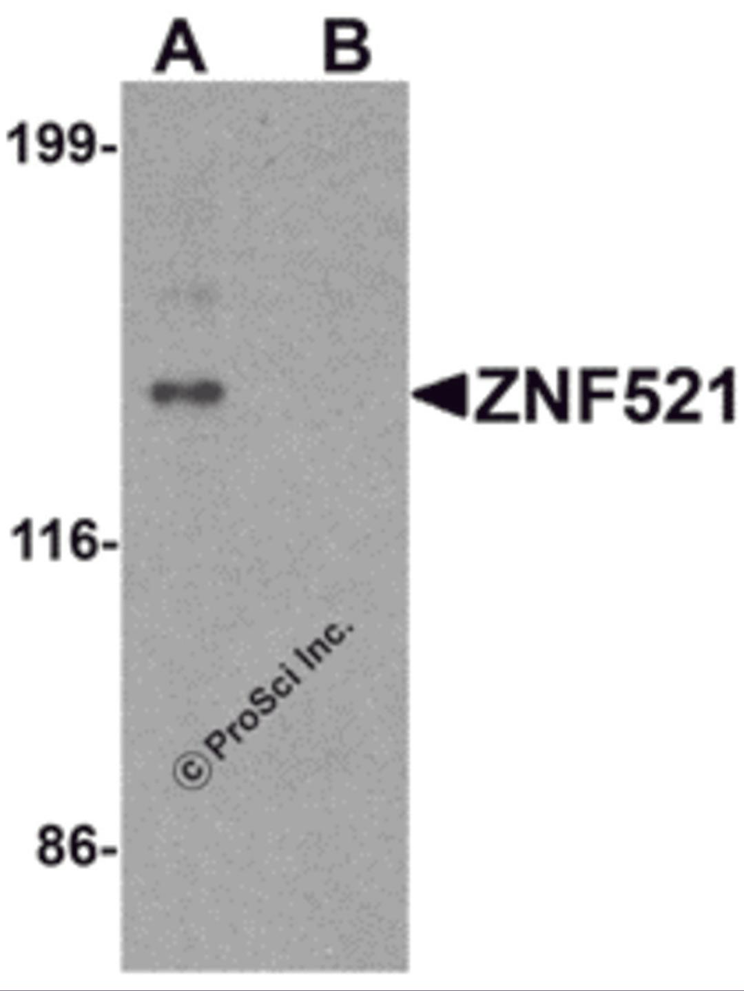 Western blot analysis of ZNF521 in HeLa cell lysate with ZNF521 antibody at 1 μg/ml in (A) the absence and (B) the presence of blocking peptide.