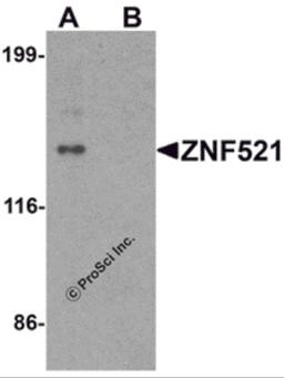 Western blot analysis of ZNF521 in HeLa cell lysate with ZNF521 antibody at 1 μg/ml in (A) the absence and (B) the presence of blocking peptide.
