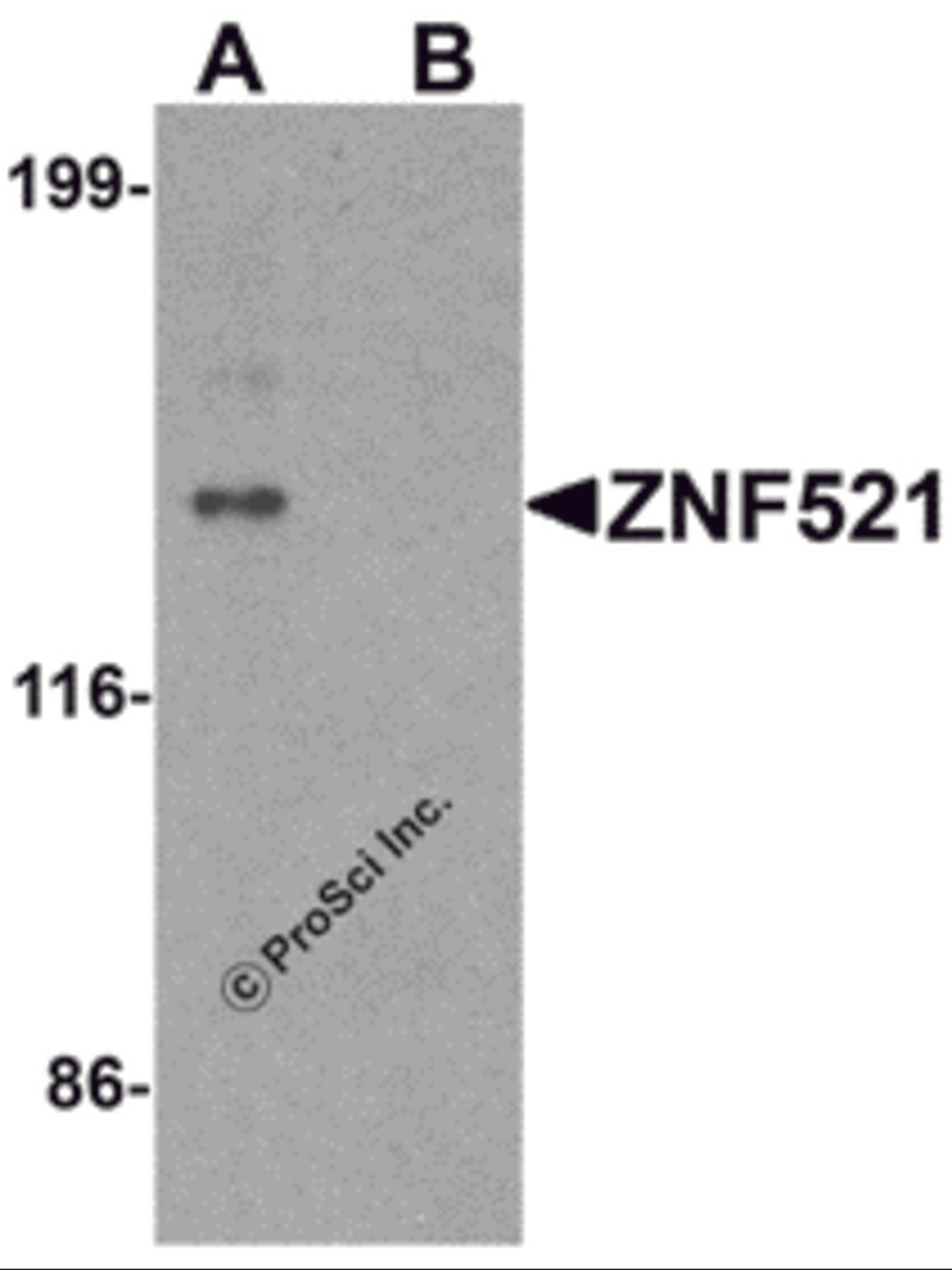 Western blot analysis of ZNF521 in HeLa cell lysate with ZNF521 antibody at 1 μg/ml in (A) the absence and (B) the presence of blocking peptide.
