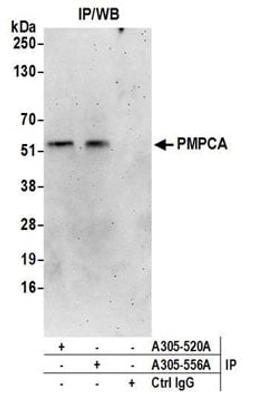 Detection of human PMPCA by western blot of immunoprecipitates.