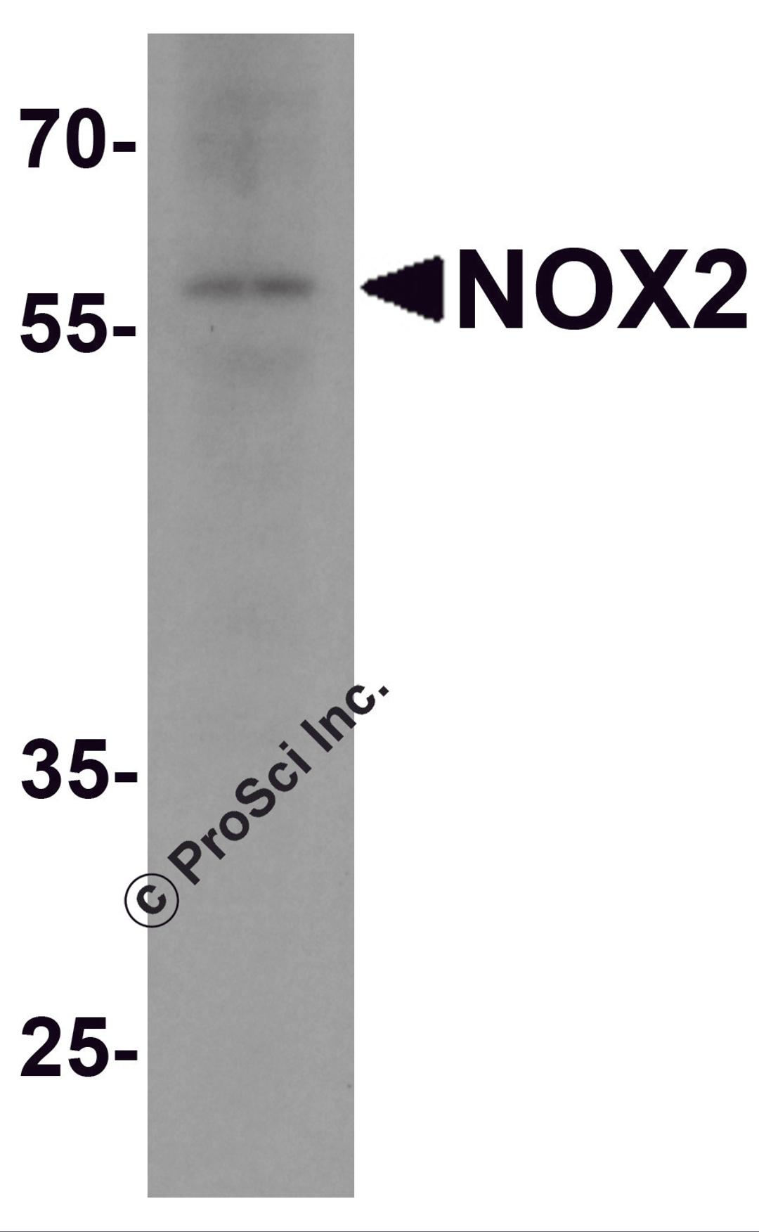 Western blot analysis of NOX2 in rat brain tissue lysate with NOX2 antibody at 1 μg/ml.