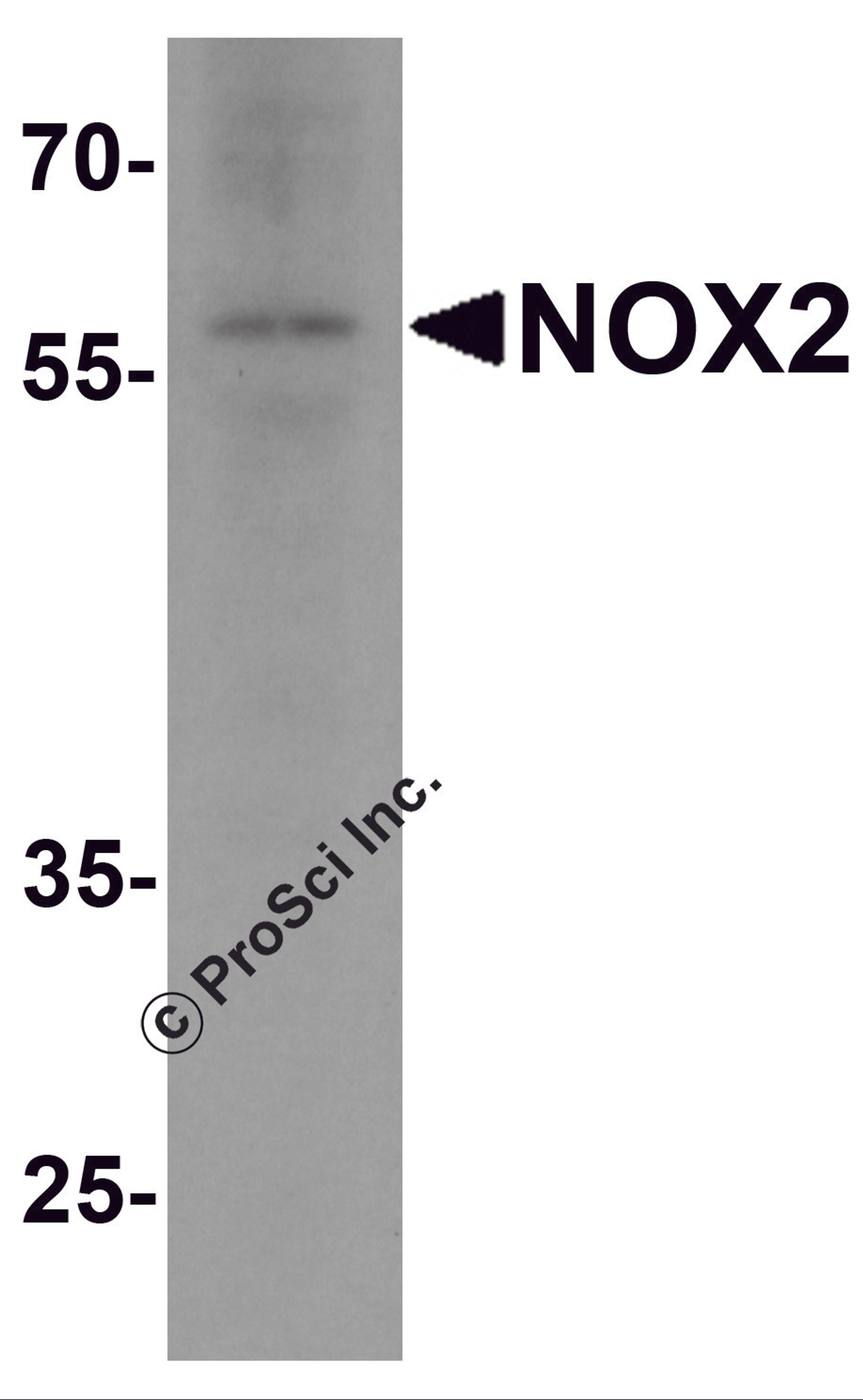 Western blot analysis of NOX2 in rat brain tissue lysate with NOX2 antibody at 1 μg/ml.