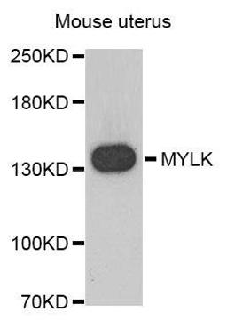 Western blot analysis of extracts of Mouse uterus using MYLK antibody