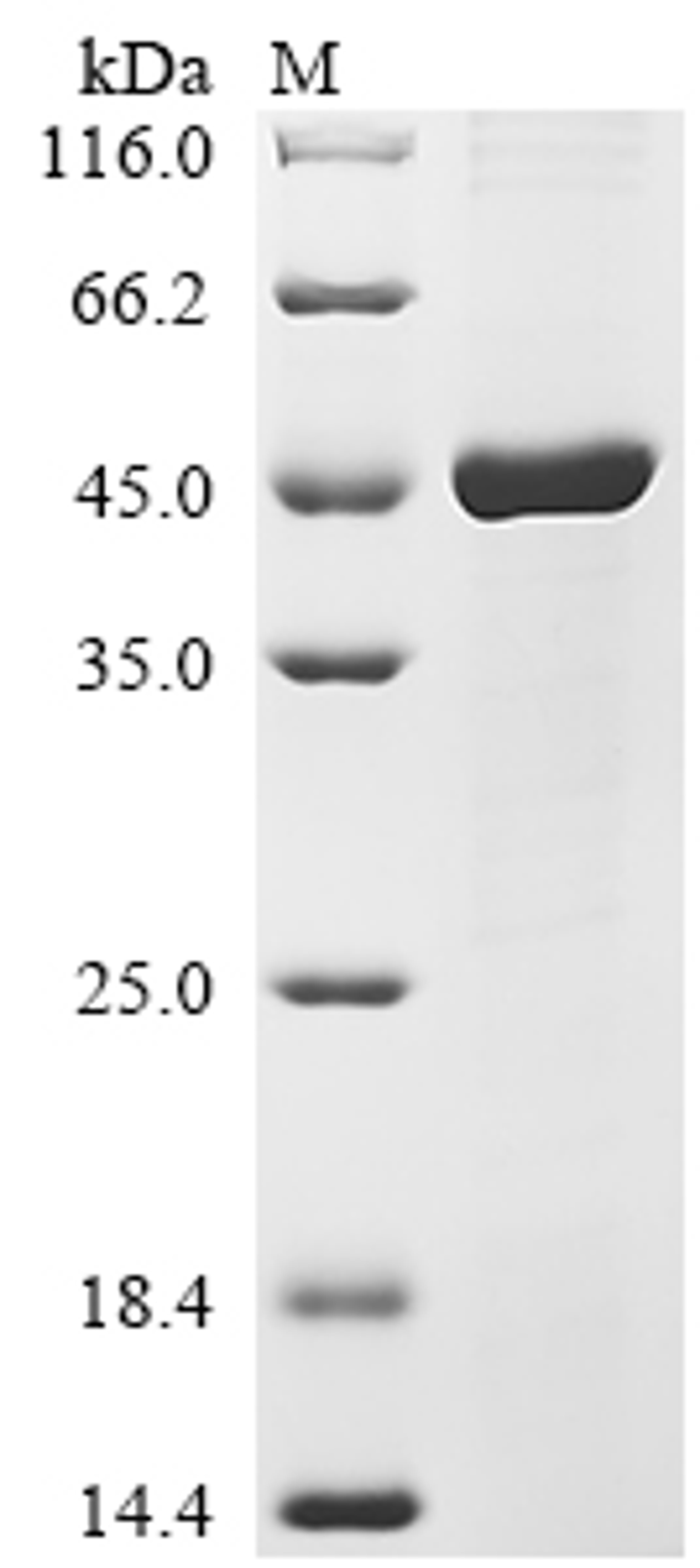 (Tris-Glycine gel) Discontinuous SDS-PAGE (reduced) with 5% enrichment gel and 15% separation gel.