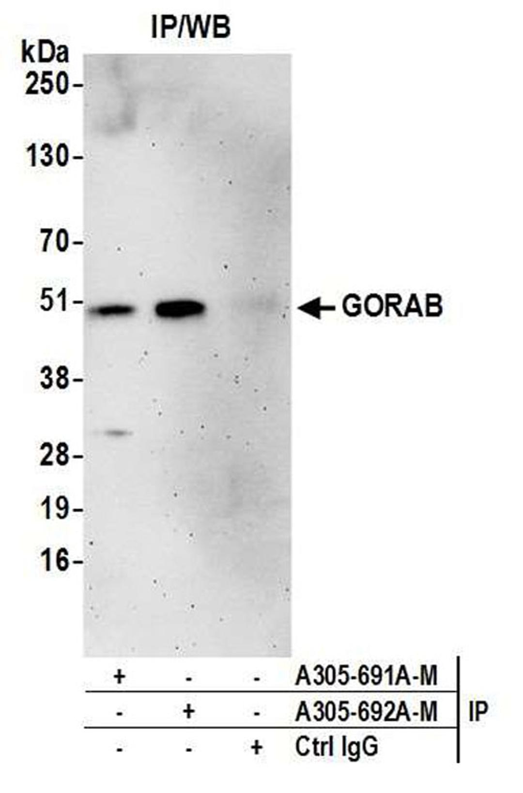 Detection of human GORAB by WB of IP.