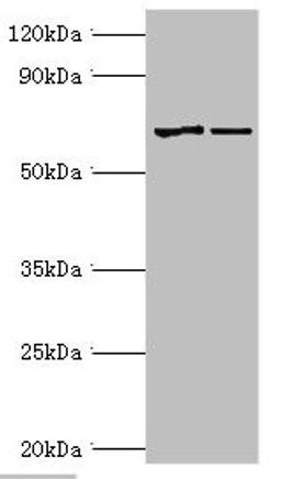 Western blot. All lanes: Myotubularin antibody at 2ug/ml. Lane 1: Jurkat whole cell lysate. Lane 2: HepG2 whole cell lysate. Secondary. Goat polyclonal to rabbit IgG at 1/10000 dilution. Predicted band size: 70, 67 kDa. Observed band size: 70 kDa.