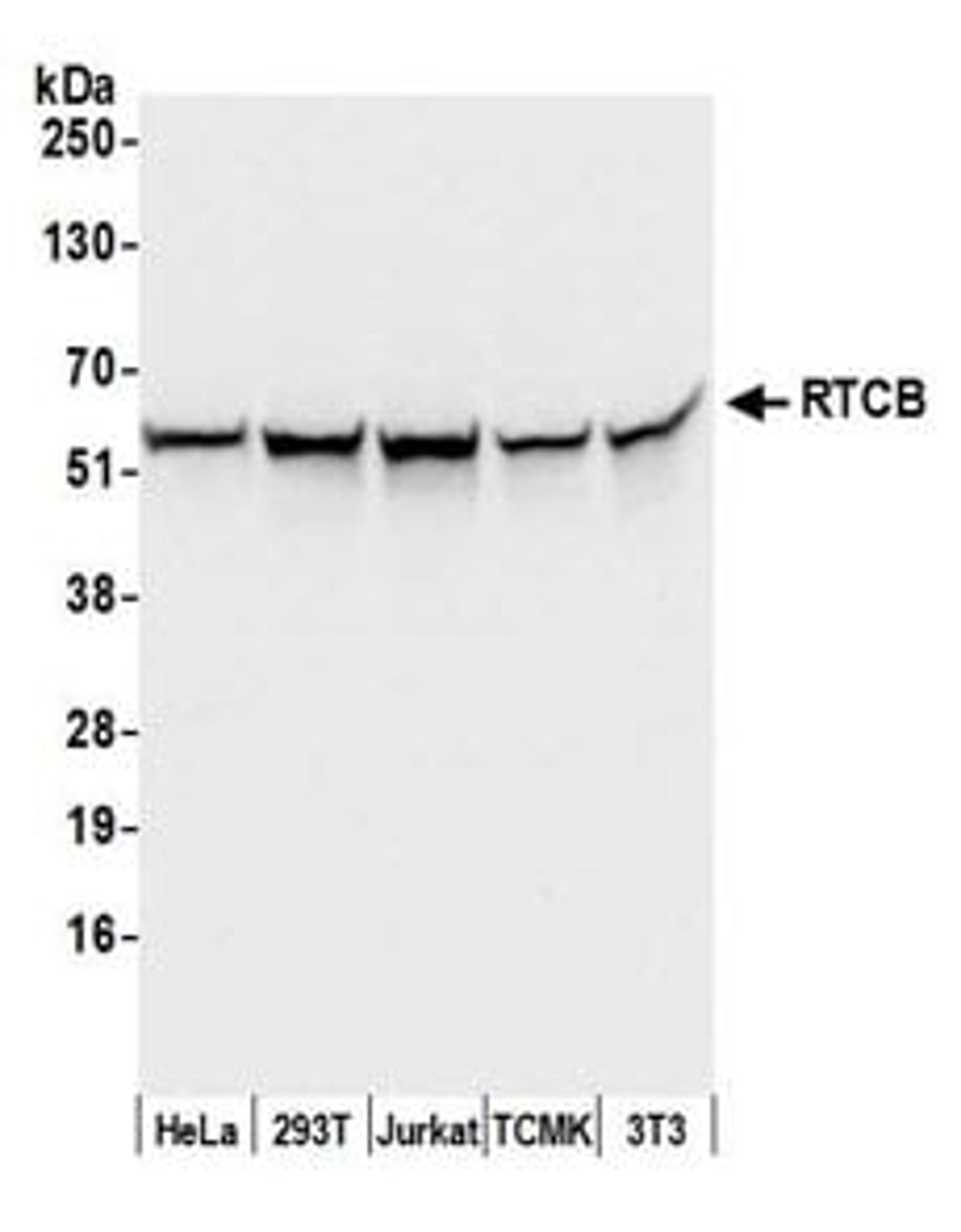 Detection of human and mouse RTCB by western blot.