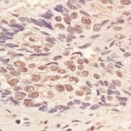 Detection of human L3MBTL3 by immunohistochemistry.