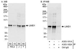 Detection of human LIMD1 by western blot and immunoprecipitation.