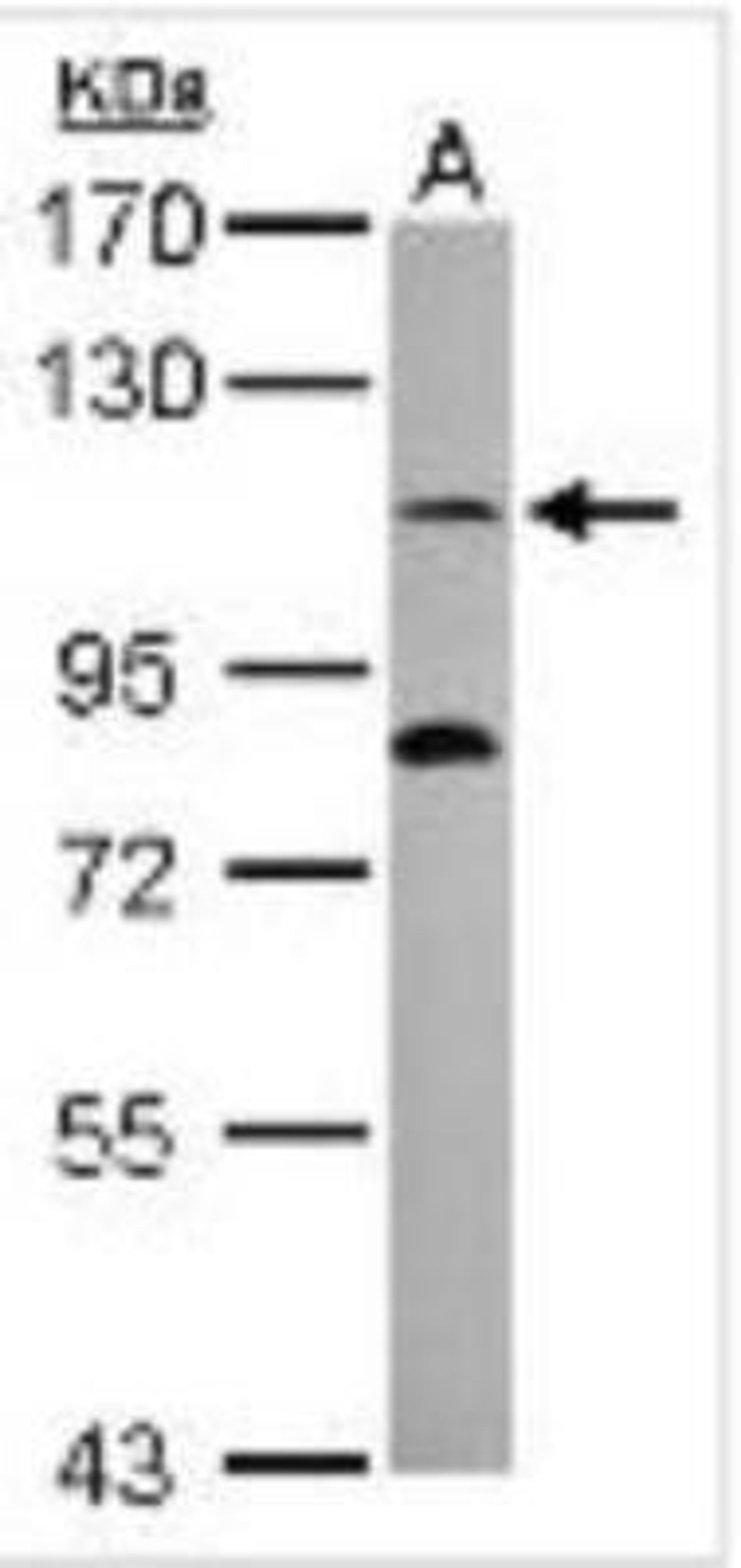 Western Blot: ENPP2 Antibody [NBP1-32162] - Mouse brown adipose tissue (50 ug whole cell lysate).