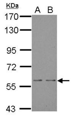 Western Blot: NOX1 Antibody [NBP1-31546] - Sample (30 ug of whole cell lysate) A: JC B: BCL-1 7. 5% SDS PAGE; antibody diluted at 1:5000.