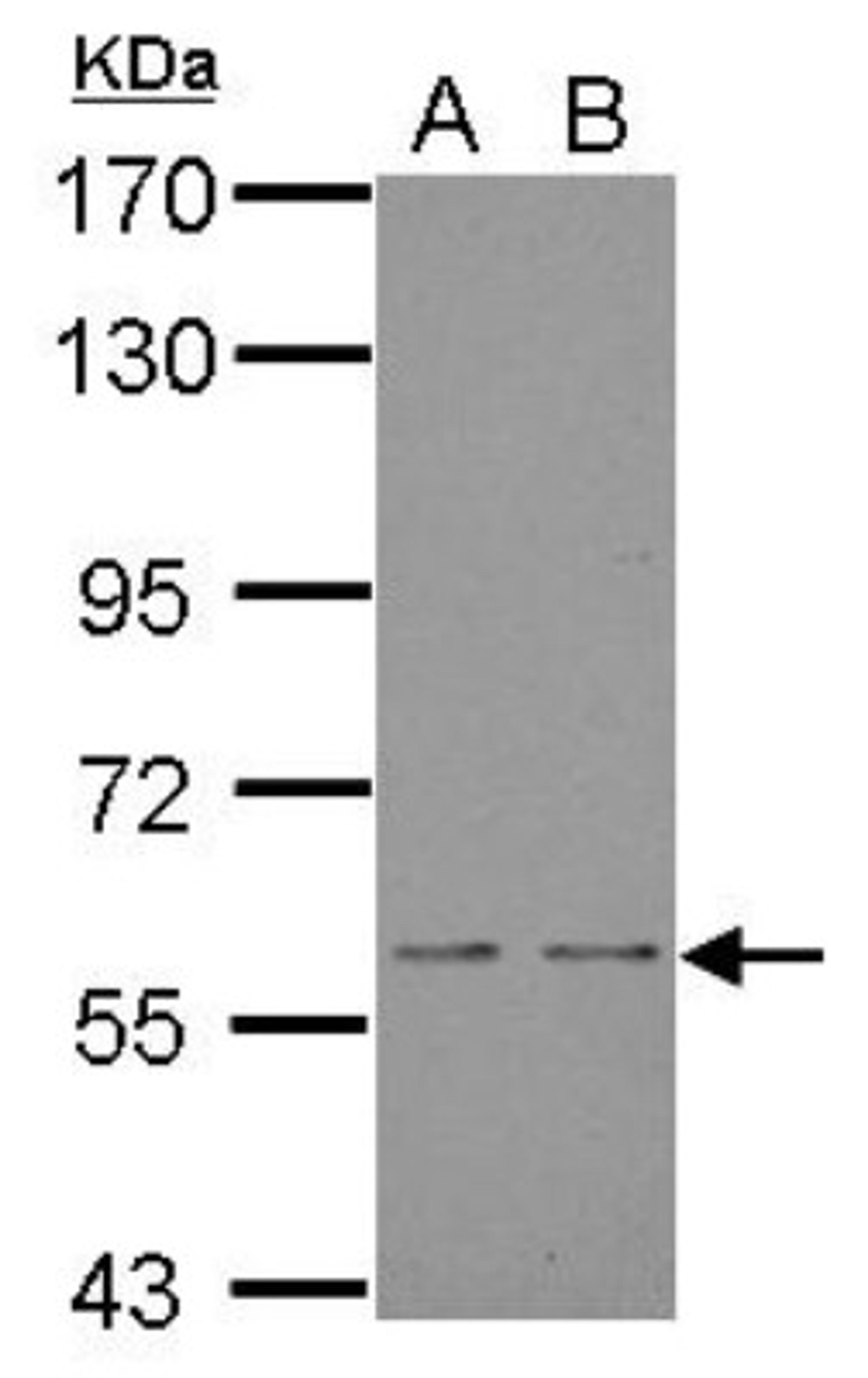 Western Blot: NOX1 Antibody [NBP1-31546] - Sample (30 ug of whole cell lysate) A: JC B: BCL-1 7. 5% SDS PAGE; antibody diluted at 1:5000.