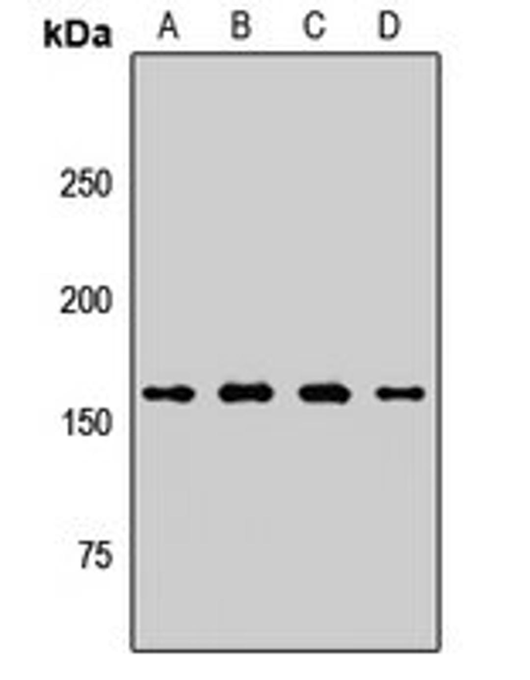 Western blot analysis of A431 (Lane1), HT29 (Lane2), mouse lung (Lane3), rat testis (Lane4) whole cell lysates using PLB1 antibody