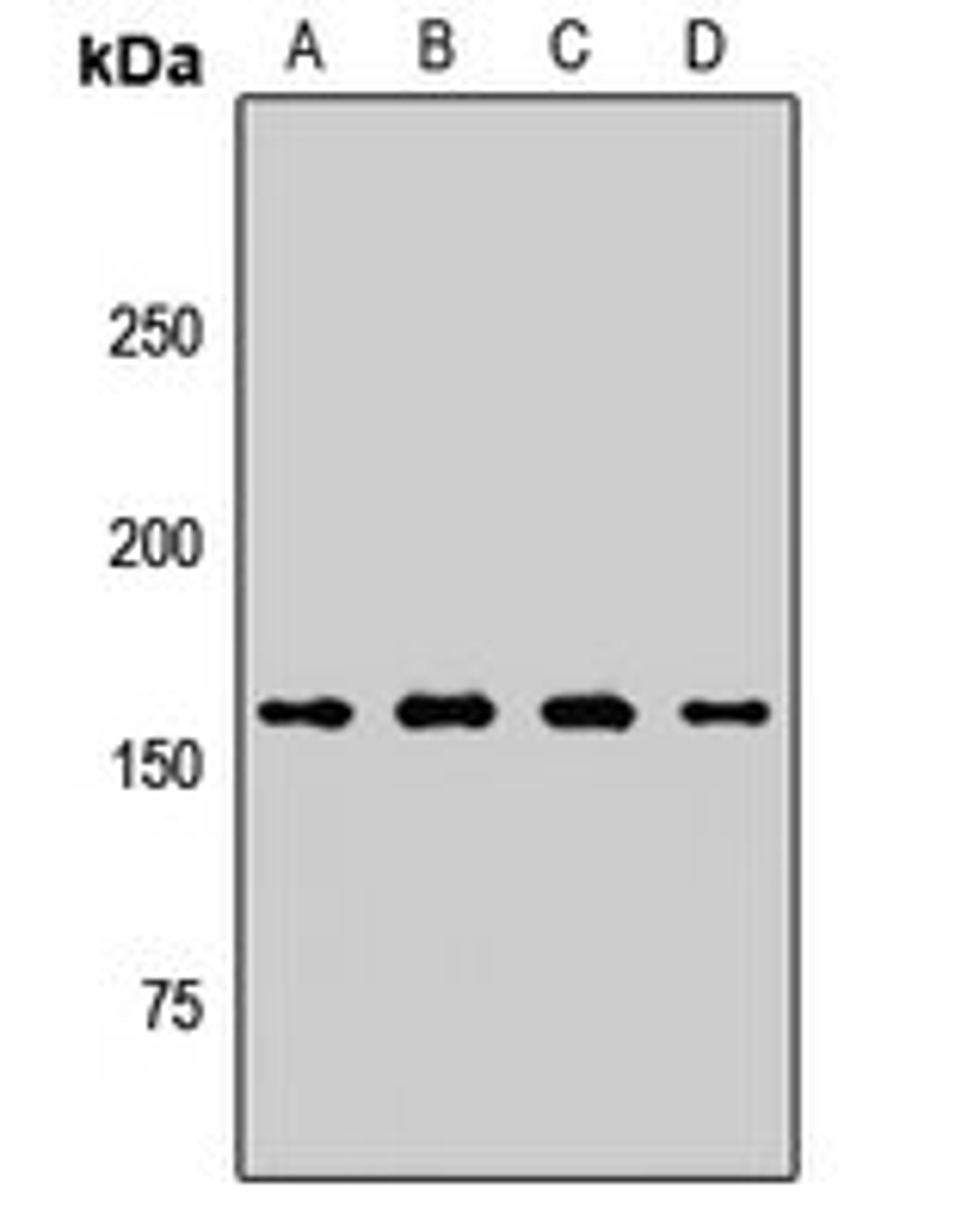 Western blot analysis of A431 (Lane1), HT29 (Lane2), mouse lung (Lane3), rat testis (Lane4) whole cell lysates using PLB1 antibody