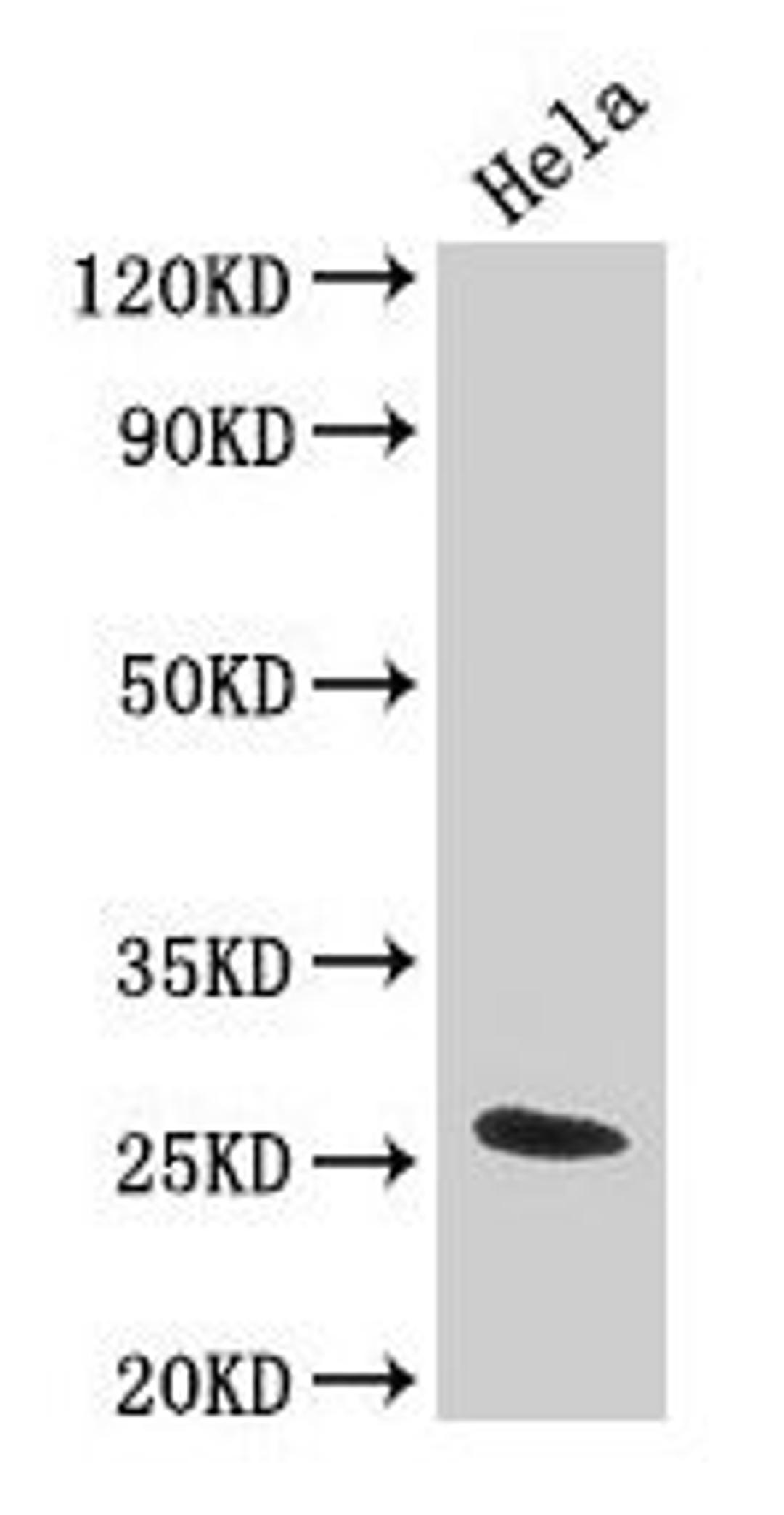 Western Blot. Positive WB detected in: Hela whole cell lysate. All lanes: TNF antibody at 3.2µg/ml. Secondary. Goat polyclonal to rabbit IgG at 1/50000 dilution. Predicted band size: 26 kDa. Observed band size: 26 kDa