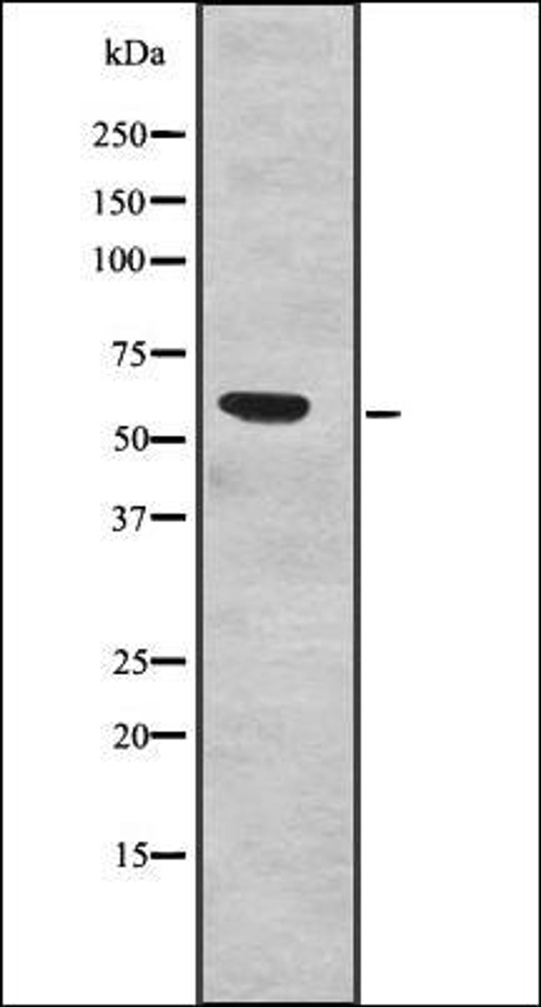 Western blot analysis of Human fetal liver lysates using SF3A3 antibody