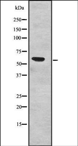 Western blot analysis of Human fetal liver lysates using SF3A3 antibody