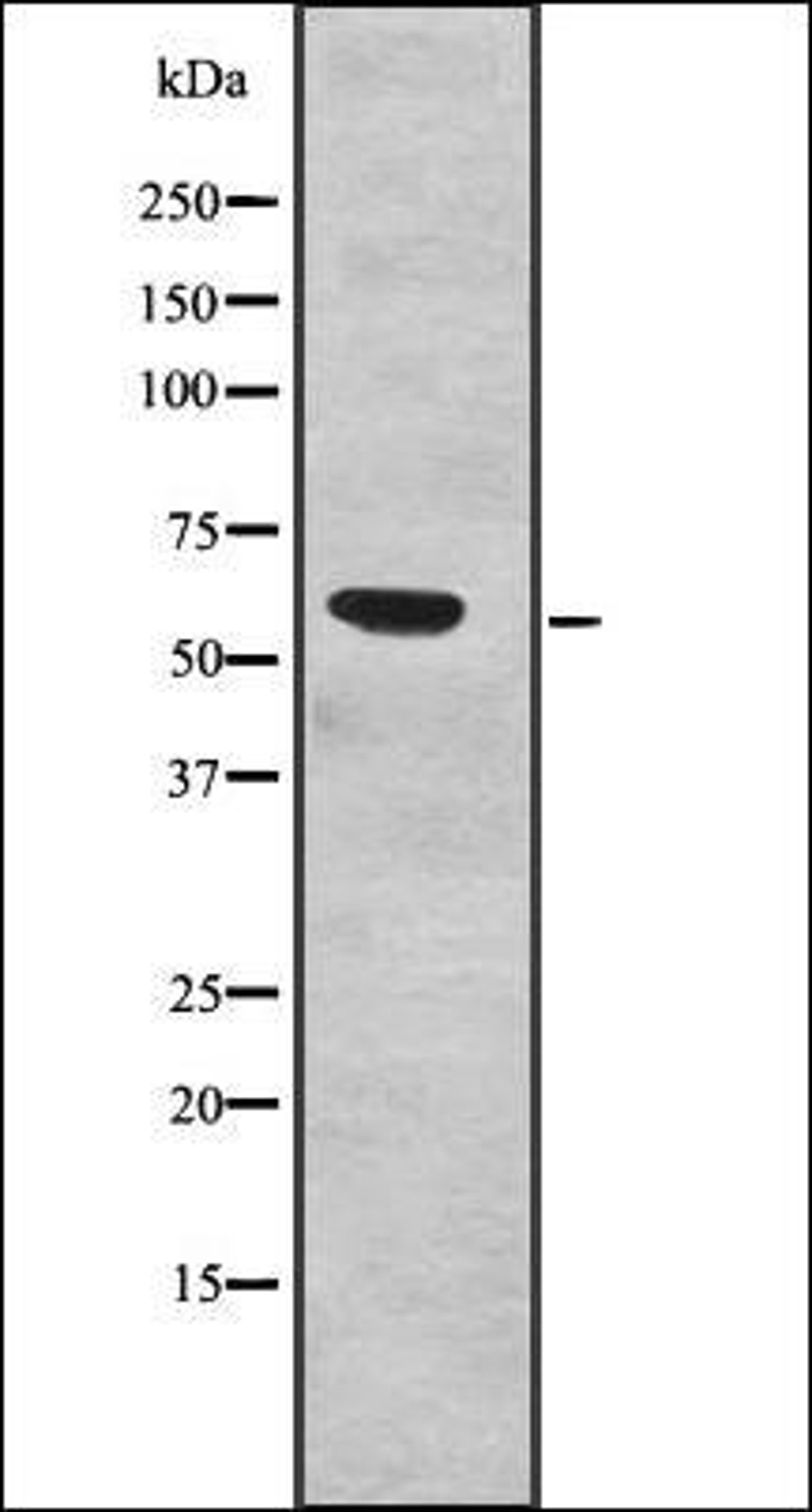 Western blot analysis of Human fetal liver lysates using SF3A3 antibody