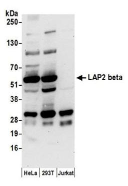 Detection of human LAP2 beta by western blot.