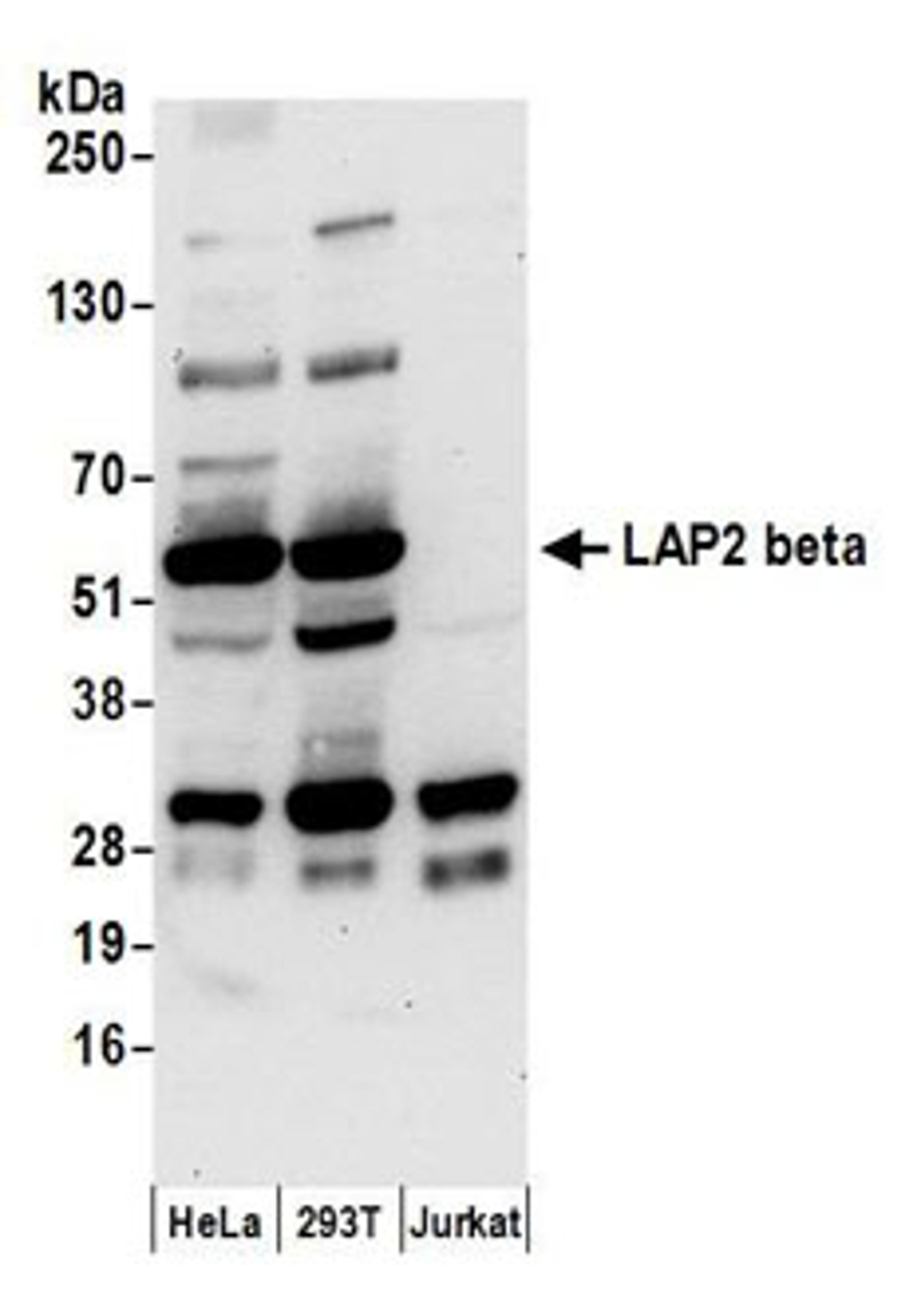 Detection of human LAP2 beta by western blot.