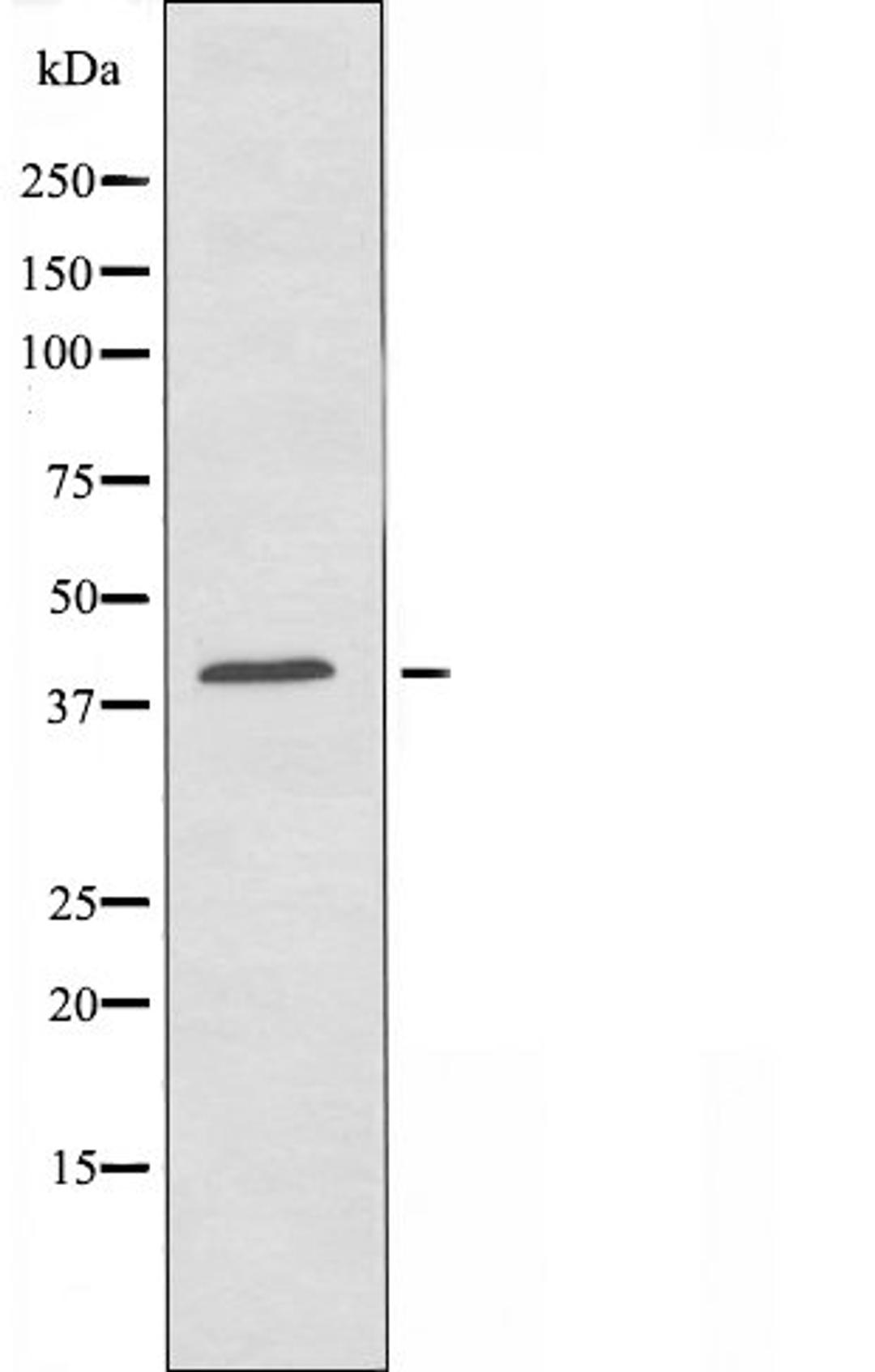 Western blot analysis of Jurkat cells using OR2AP1 antibody