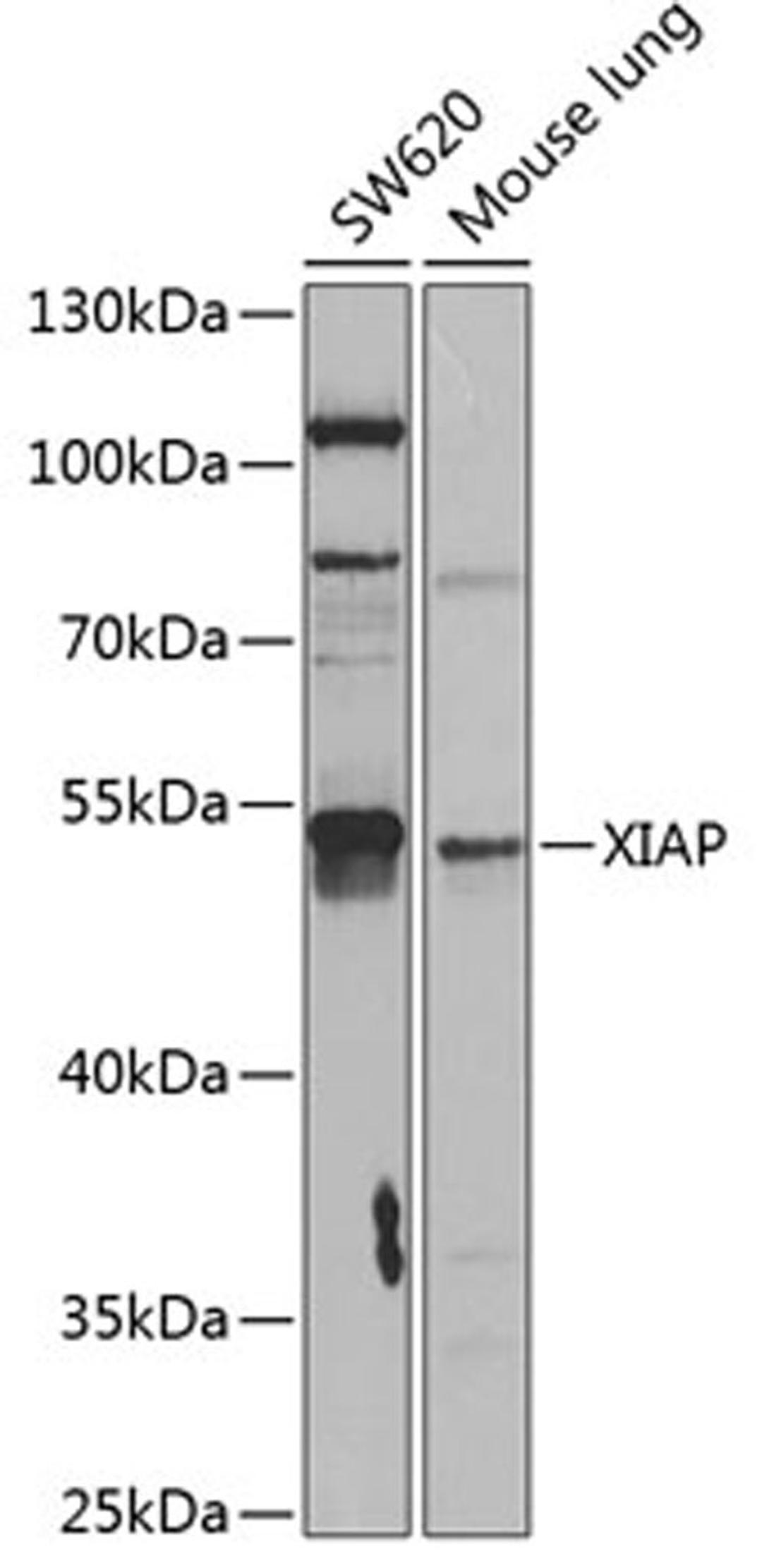 Western blot - XIAP antibody (A13277)