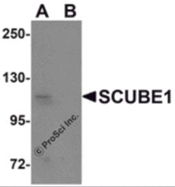 Western blot analysis of SCUBE1 in Daudi cell lysate with SCUBE1 antibody at 1 &#956;g/mL in (A) the absence and (B) the presence of blocking peptide.