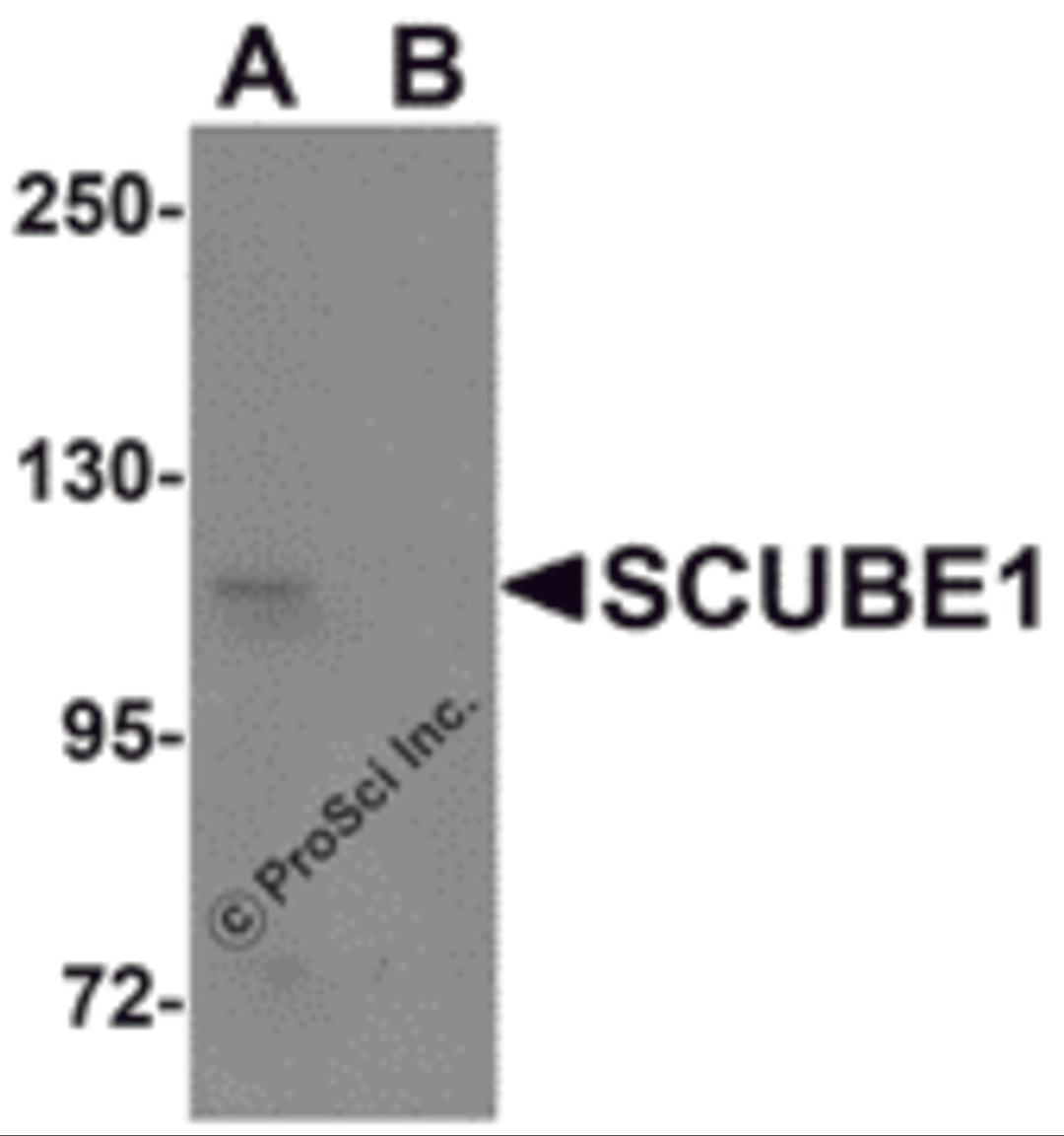 Western blot analysis of SCUBE1 in Daudi cell lysate with SCUBE1 antibody at 1 μg/mL in (A) the absence and (B) the presence of blocking peptide.