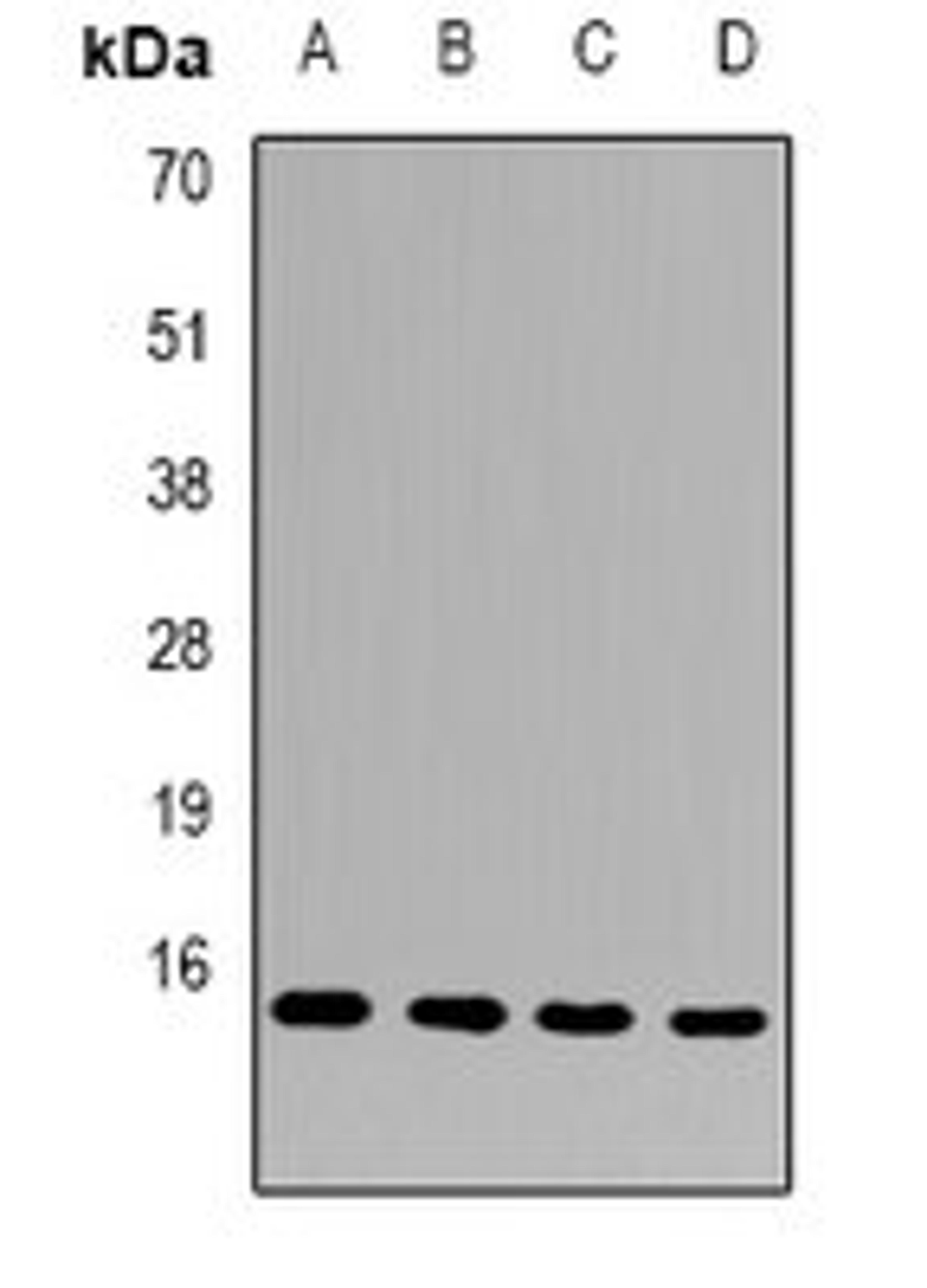 Western blot analysis of Hela (Lane1), MCF7 (Lane2), mouse heart (Lane3), mouse testis (Lane4) whole cell lysates using FAM96B antibody