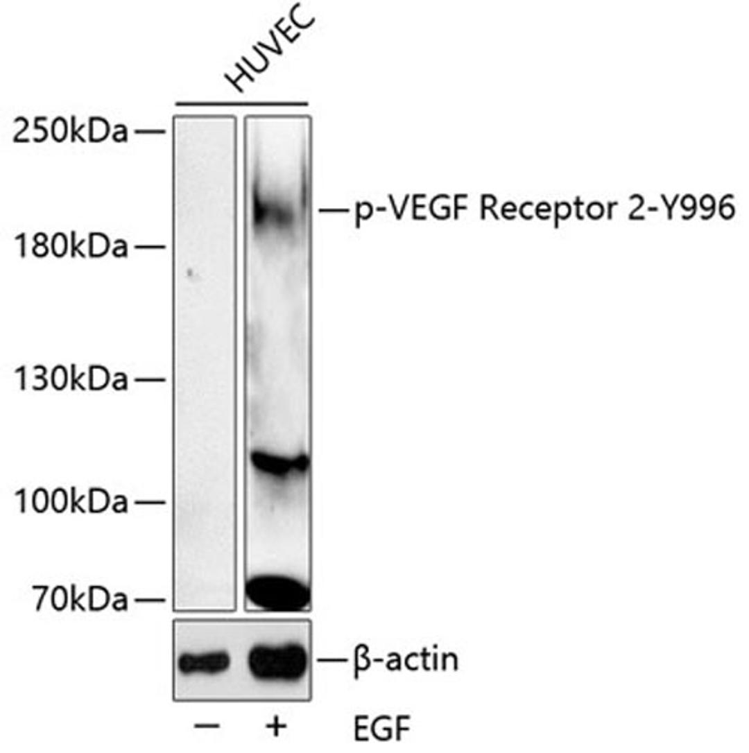 Western blot - Phospho-VEGF Receptor 2-Y996 antibody (AP0595)