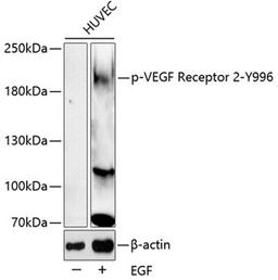 Western blot - Phospho-VEGF Receptor 2-Y996 antibody (AP0595)