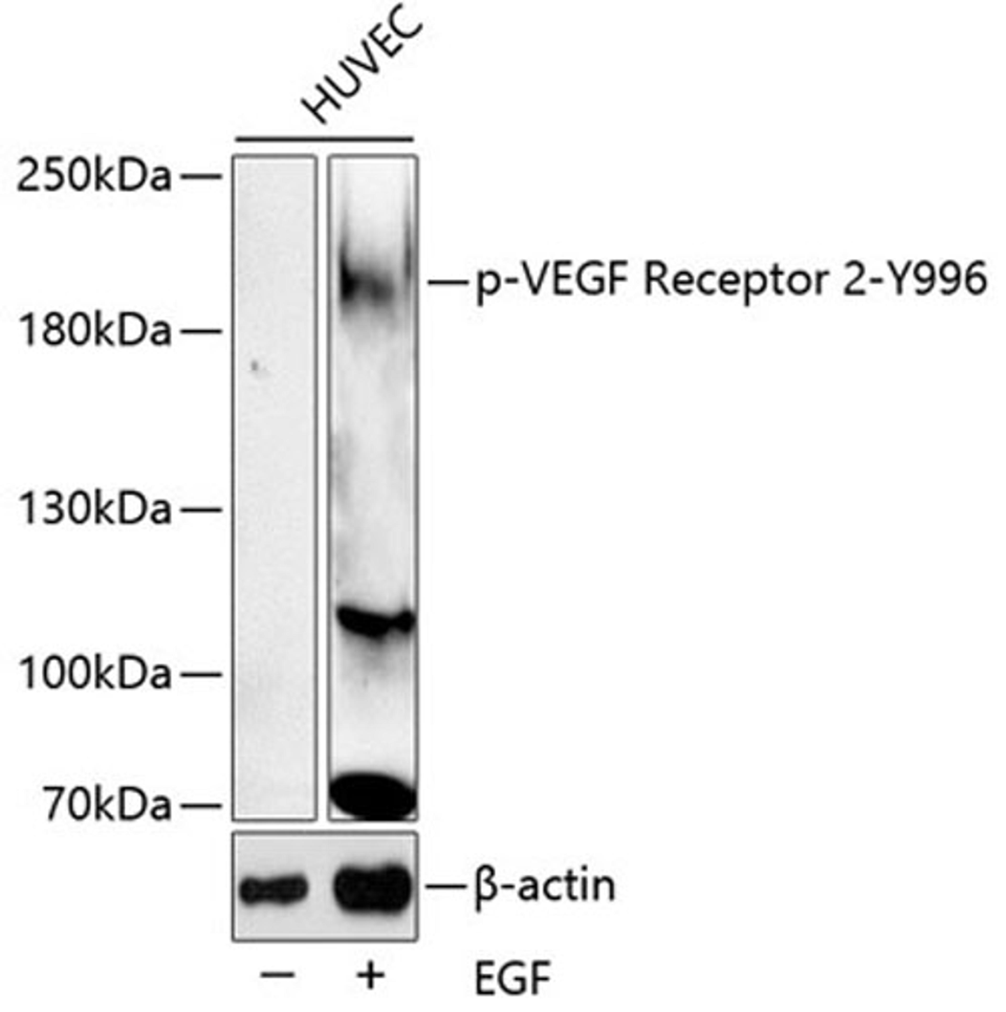 Western blot - Phospho-VEGF Receptor 2-Y996 antibody (AP0595)