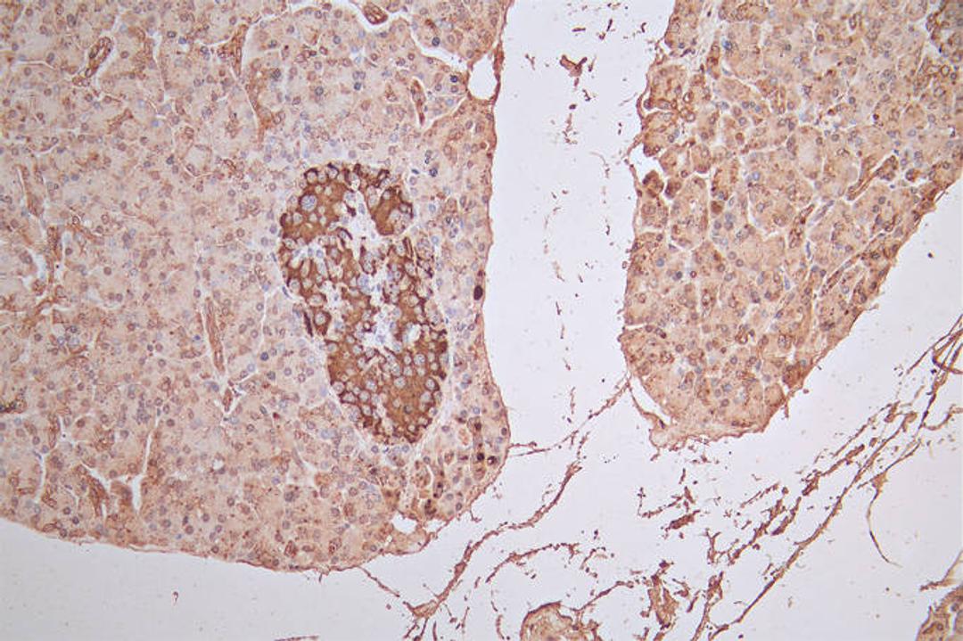 IHC image of CSB-RA008642MA1HU diluted at 1:100 and staining in paraffin-embedded human pancreatic tissue performed on a Leica BondTM system. After dewaxing and hydration,  antigen retrieval was mediated by high pressure in a citrate buffer (pH 6.0). Section was blocked with 10% normal goat serum 30min at RT. Then primary antibody (1% BSA) was incubated at 4°C overnight. The primary is detected by a Goat anti-Rabbit IgG labeled by HRP and visualized using 0.05% DAB.