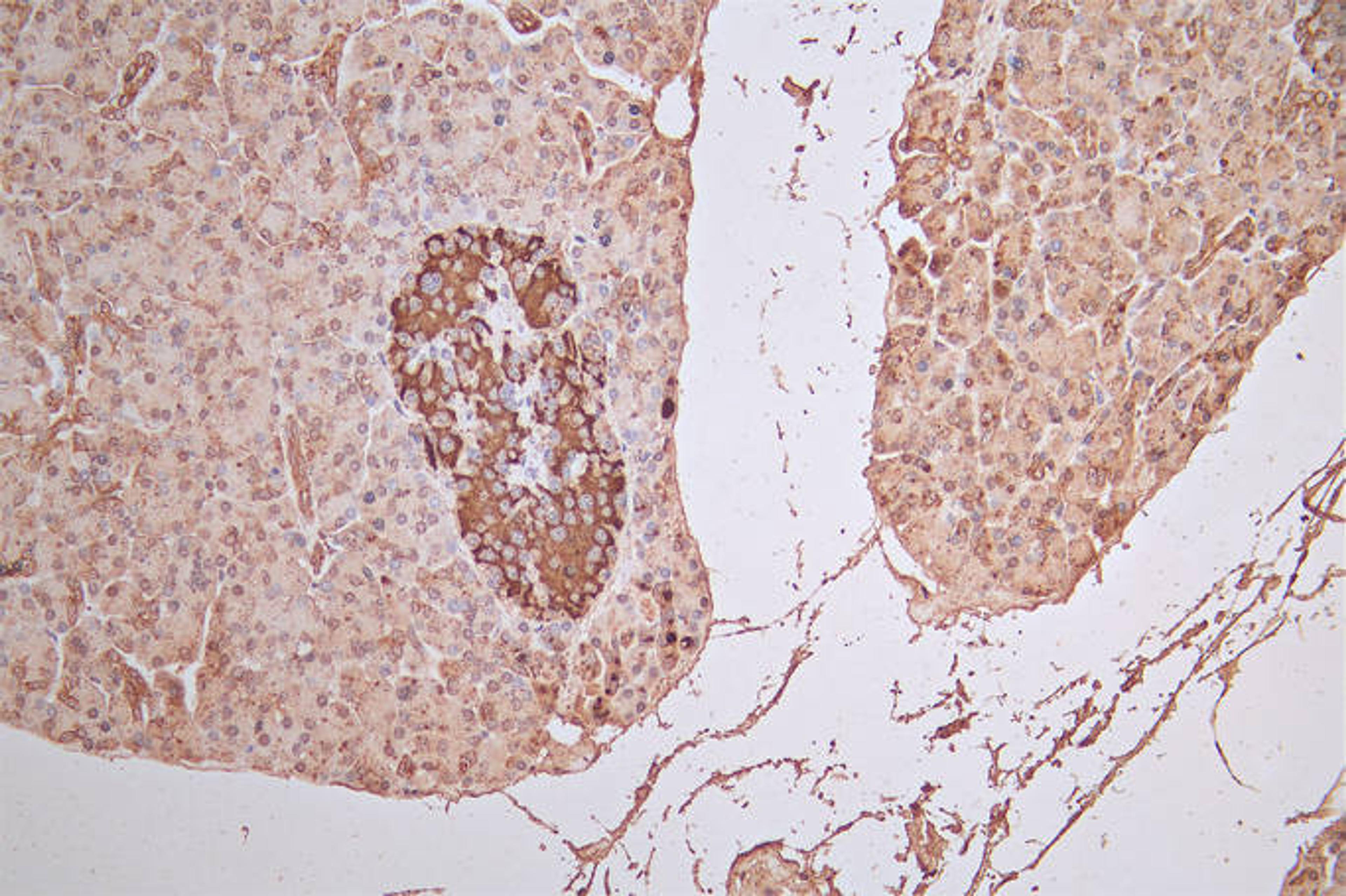 IHC image of CSB-RA008642MA1HU diluted at 1:100 and staining in paraffin-embedded human pancreatic tissue performed on a Leica BondTM system. After dewaxing and hydration,  antigen retrieval was mediated by high pressure in a citrate buffer (pH 6.0). Section was blocked with 10% normal goat serum 30min at RT. Then primary antibody (1% BSA) was incubated at 4°C overnight. The primary is detected by a Goat anti-Rabbit IgG labeled by HRP and visualized using 0.05% DAB.