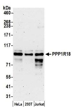 Detection of human PPP1R18 by WB.