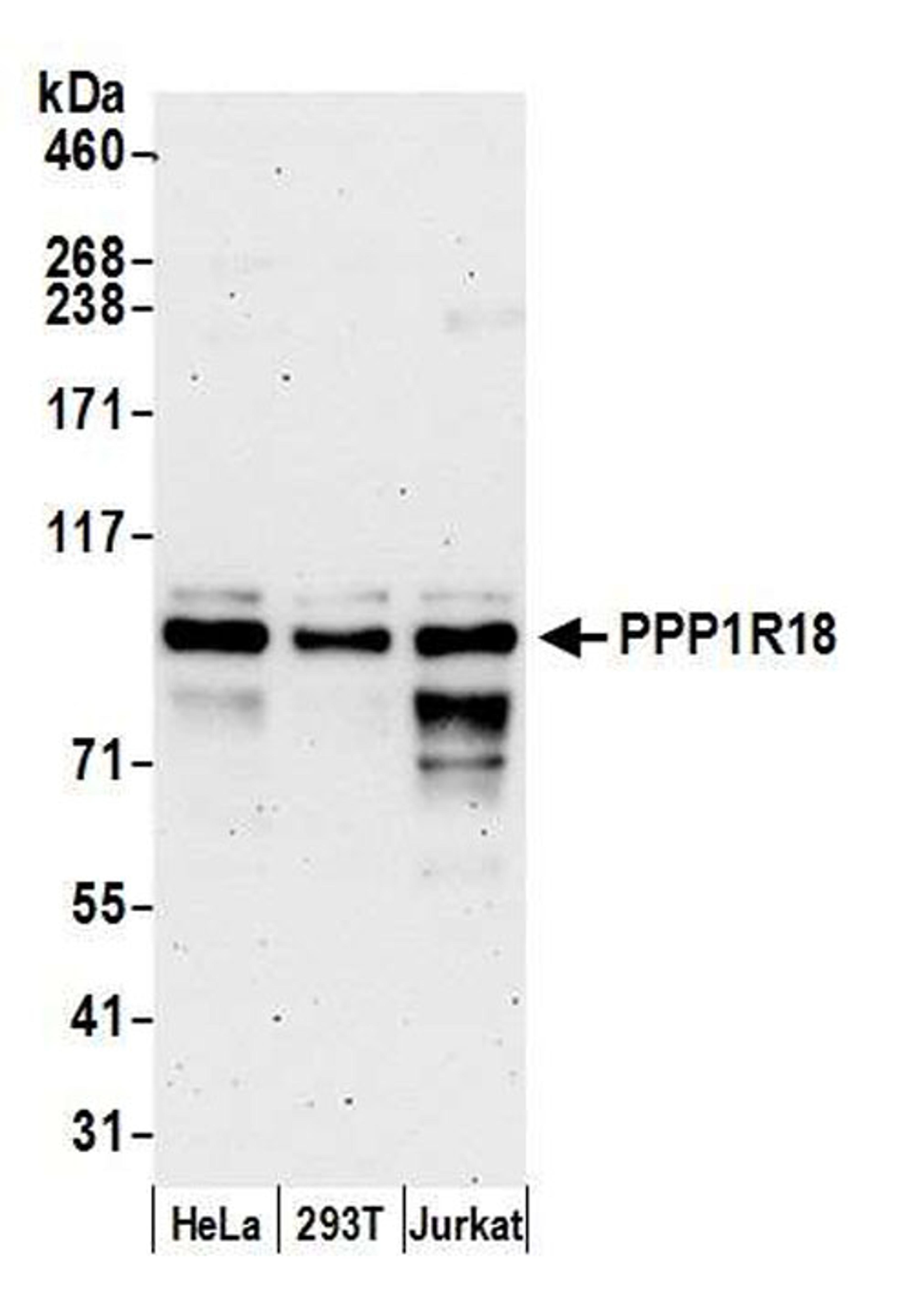 Detection of human PPP1R18 by WB.