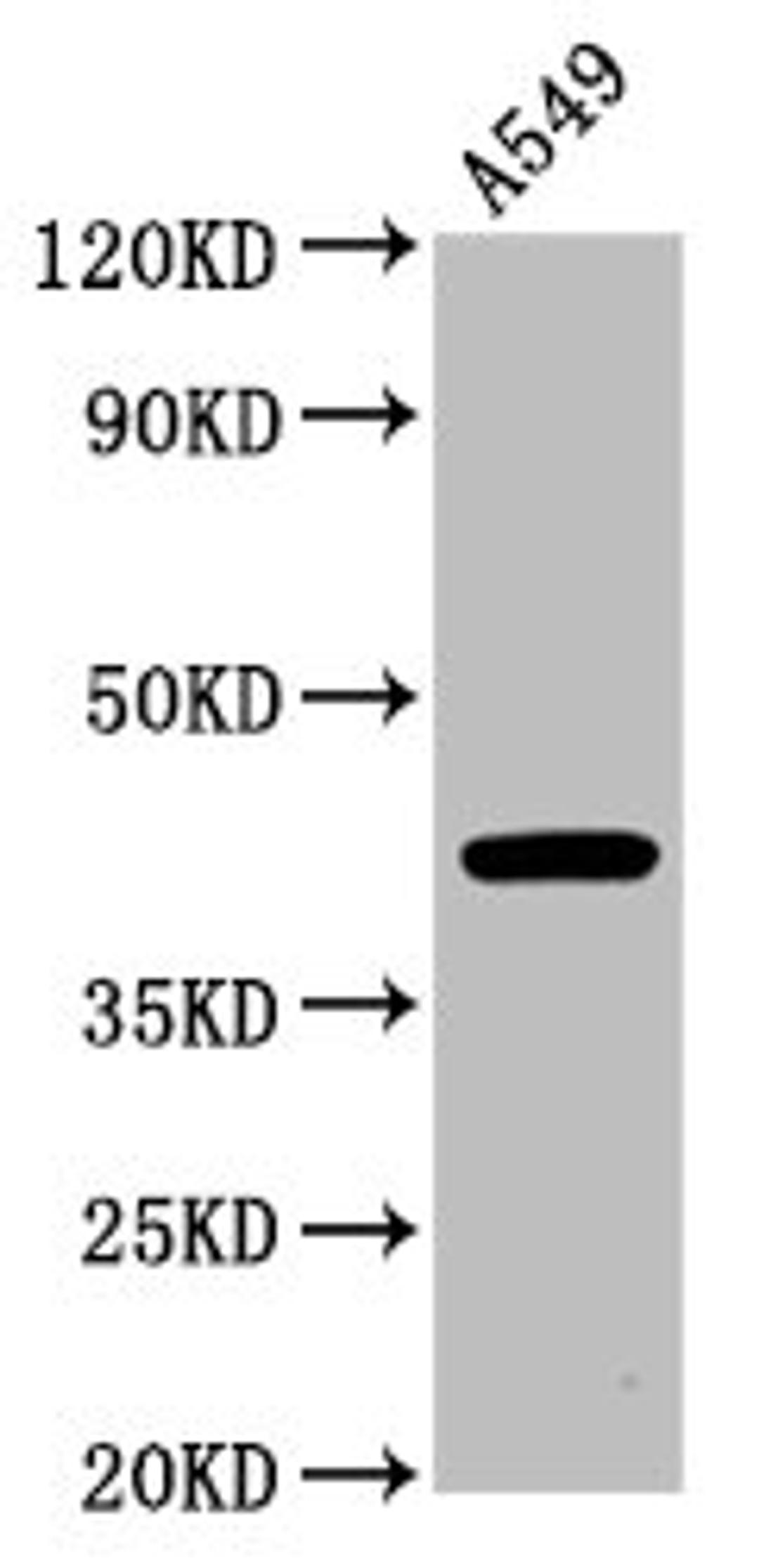 Western Blot. Positive WB detected in: A549 whole cell lysate. All lanes: CHST14 antibody at 4.8µg/ml. Secondary. Goat polyclonal to rabbit IgG at 1/50000 dilution. Predicted band size: 43 kDa. Observed band size: 43 kDa