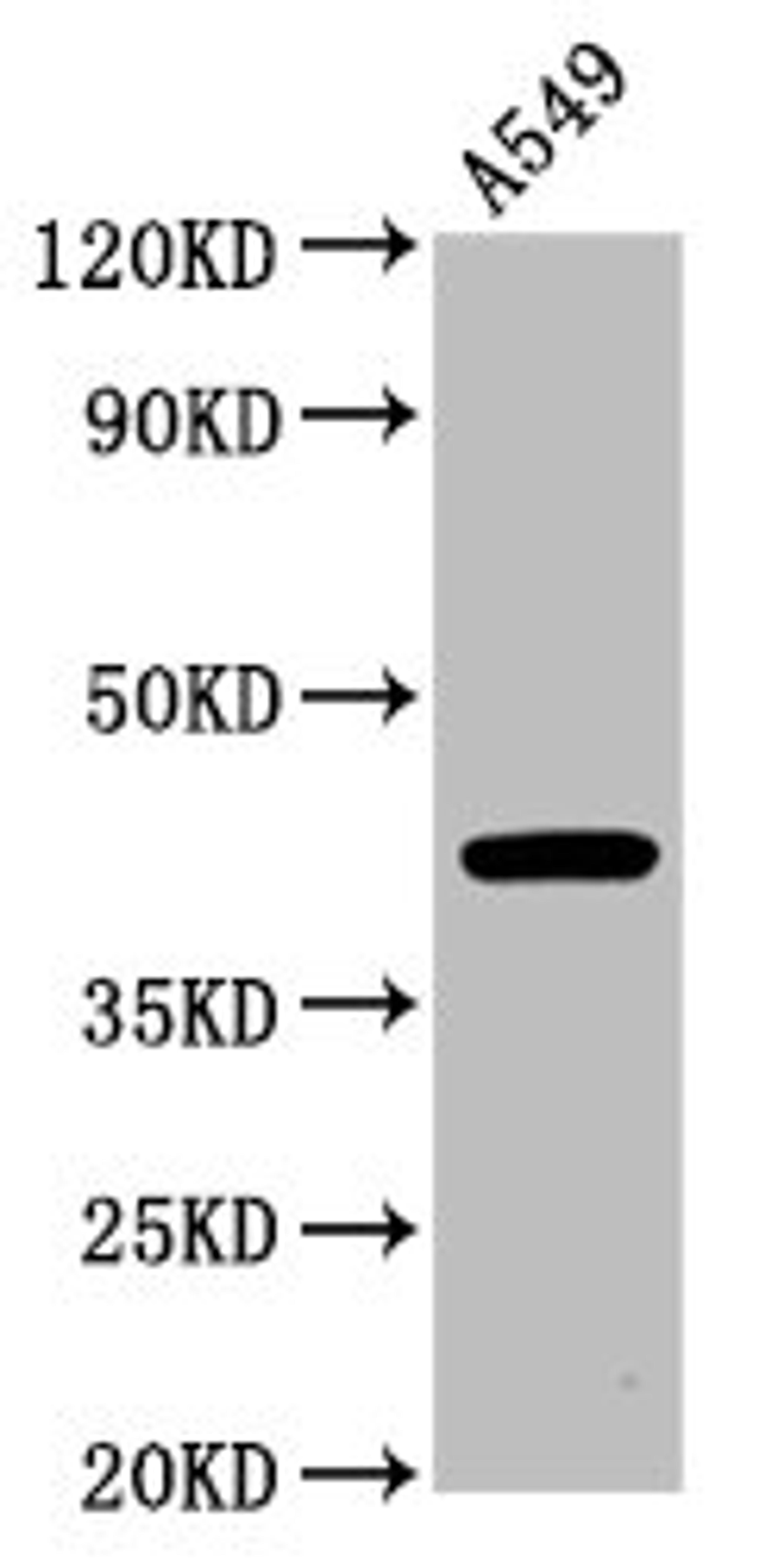 Western Blot. Positive WB detected in: A549 whole cell lysate. All lanes: CHST14 antibody at 4.8µg/ml. Secondary. Goat polyclonal to rabbit IgG at 1/50000 dilution. Predicted band size: 43 kDa. Observed band size: 43 kDa