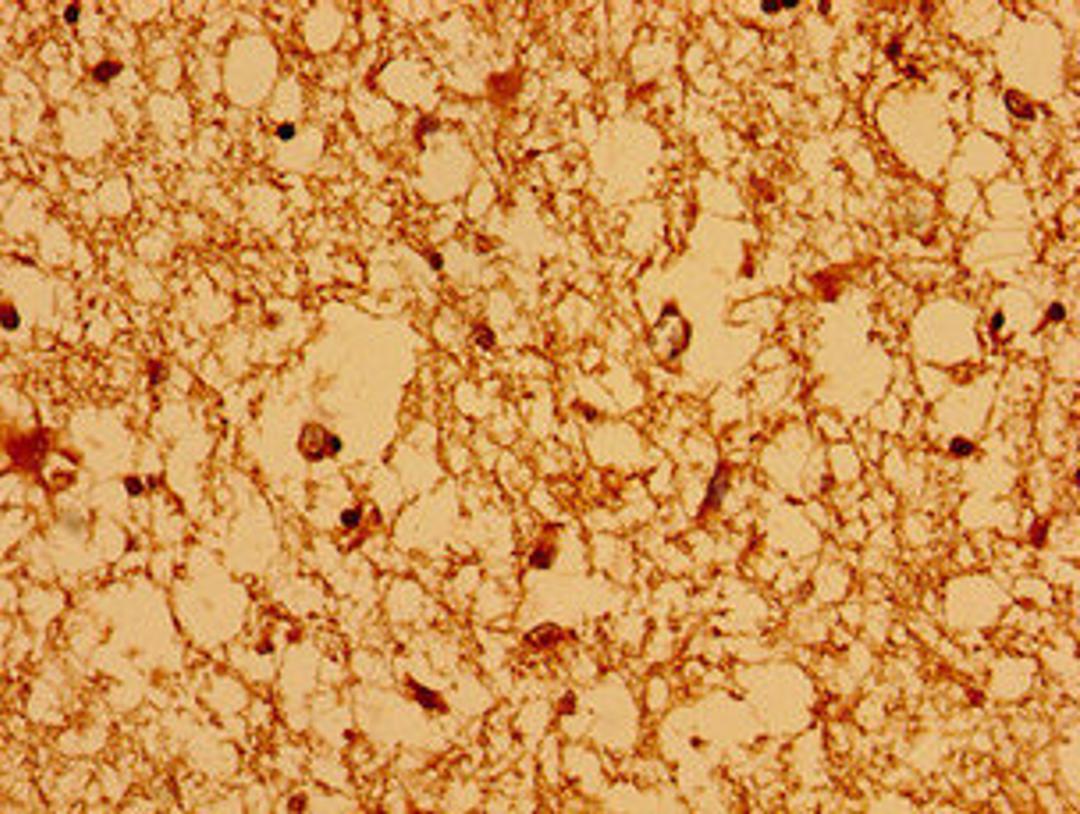 Immunohistochemistry of paraffin-embedded human brain tissue using CSB-PA897472LA01HU at dilution of 1:100